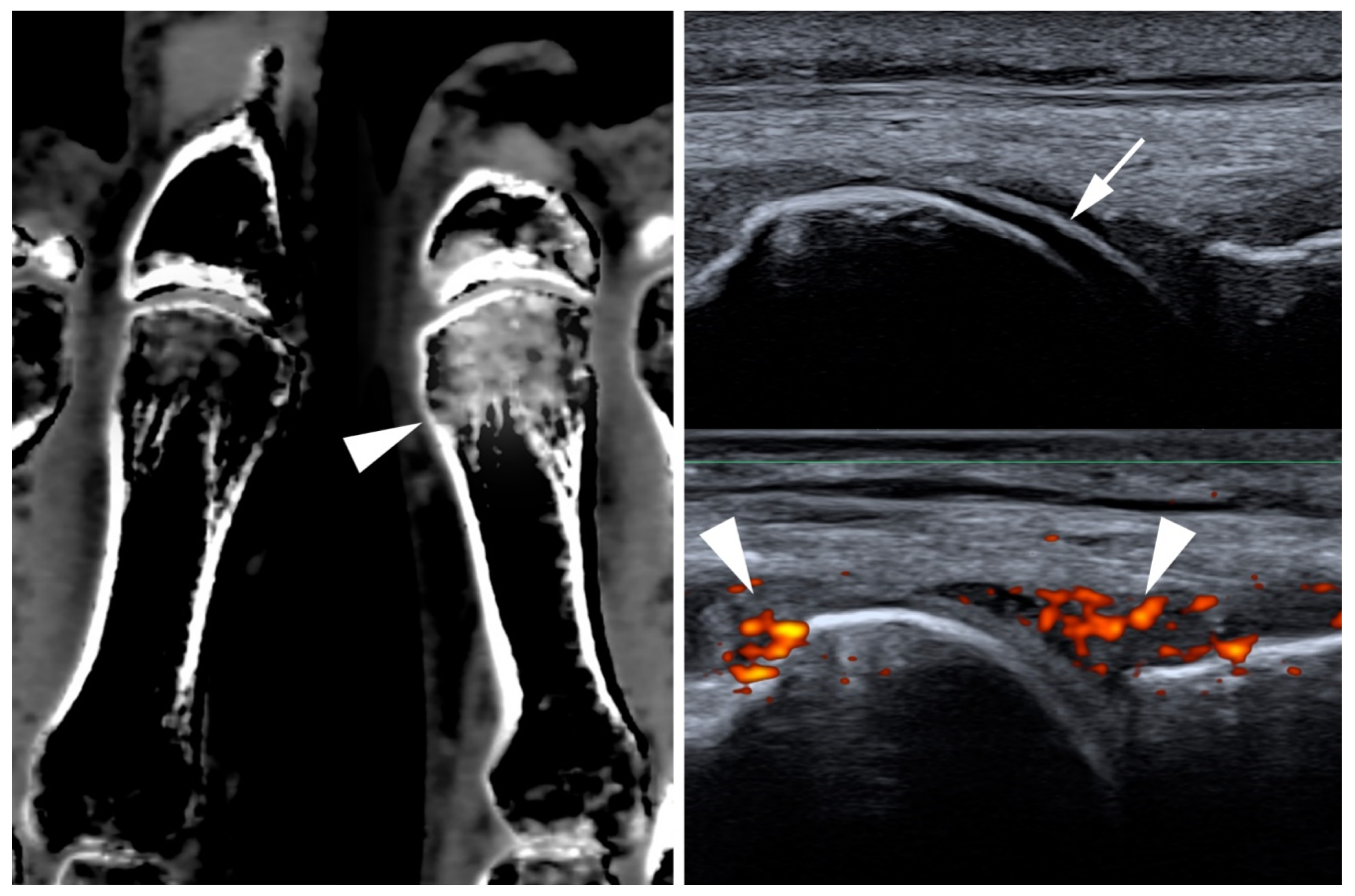 Jcm 09 04074 g002 Jcm 09 04074 g002