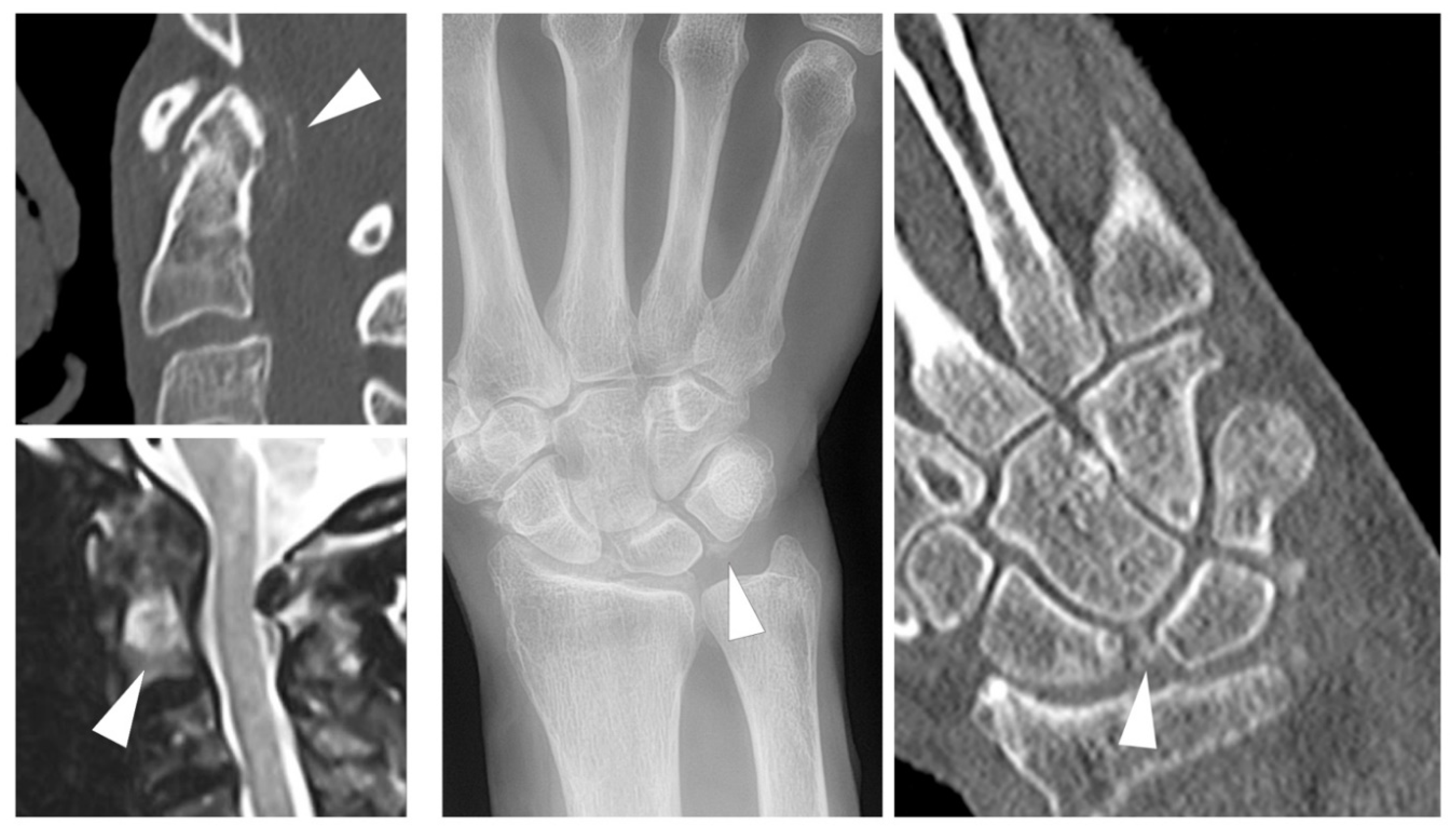 Jcm 09 04074 g003 Jcm 09 04074 g003