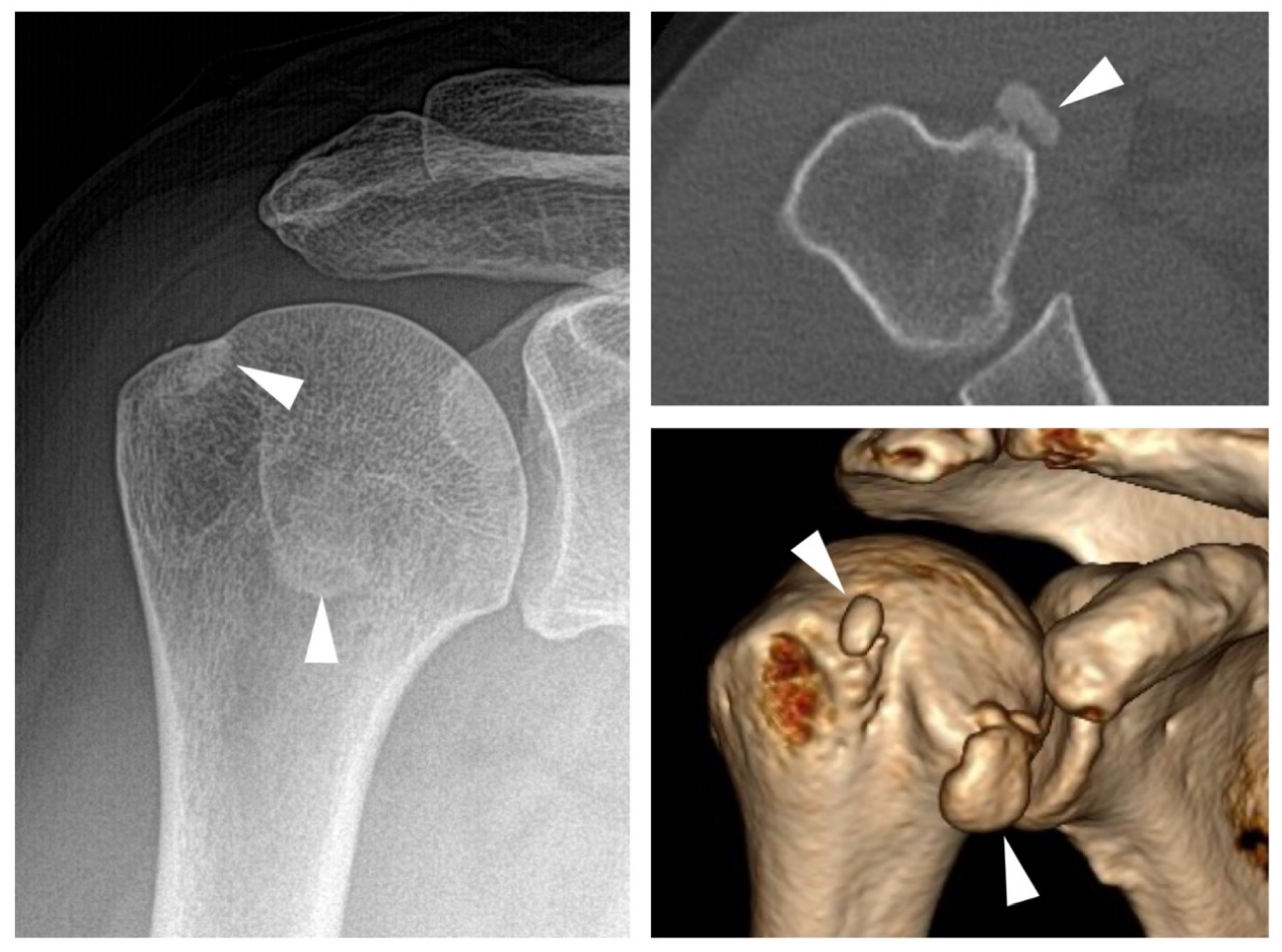 Jcm 09 04074 g004 Jcm 09 04074 g004