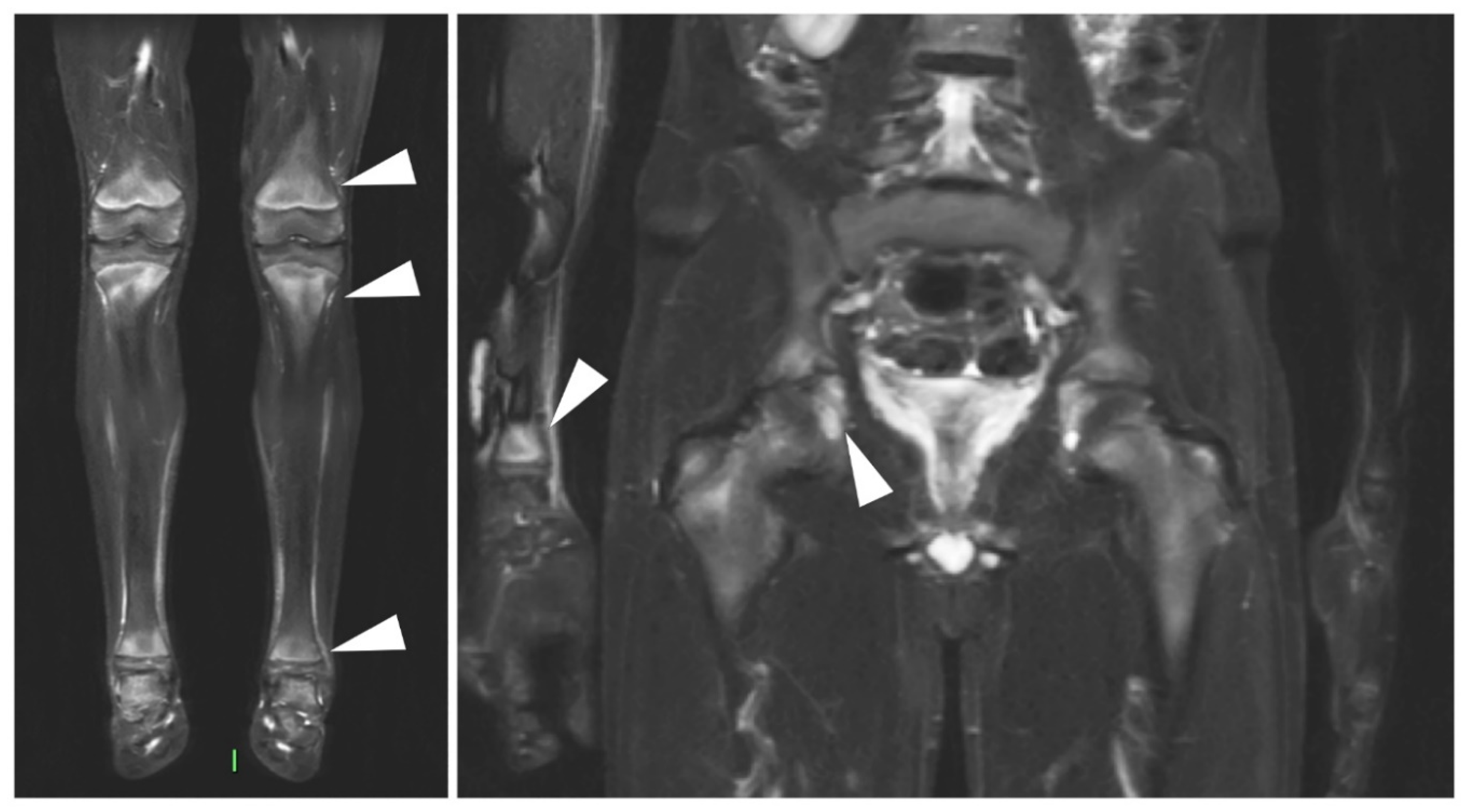Jcm 09 04074 g005 Jcm 09 04074 g005