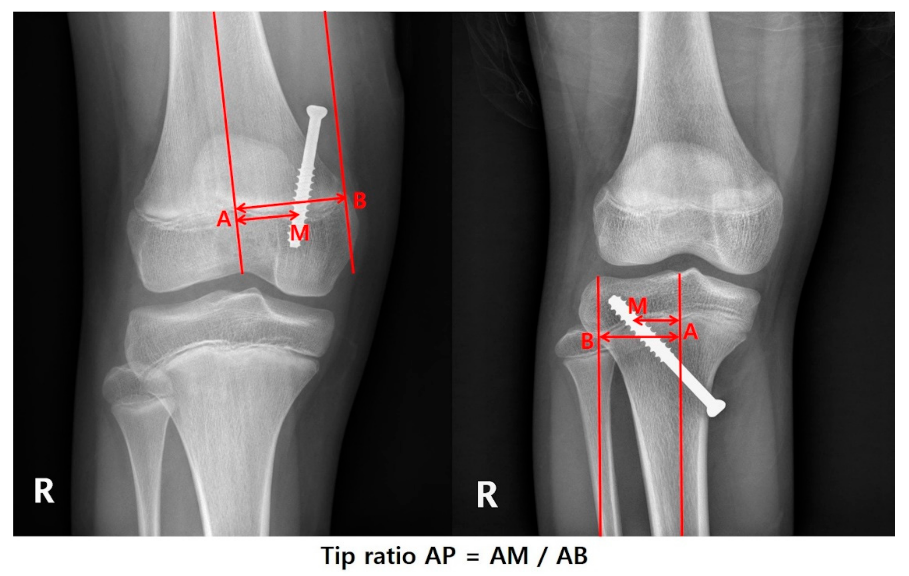 Jcm 09 04093 g001 Jcm 09 04093 g001