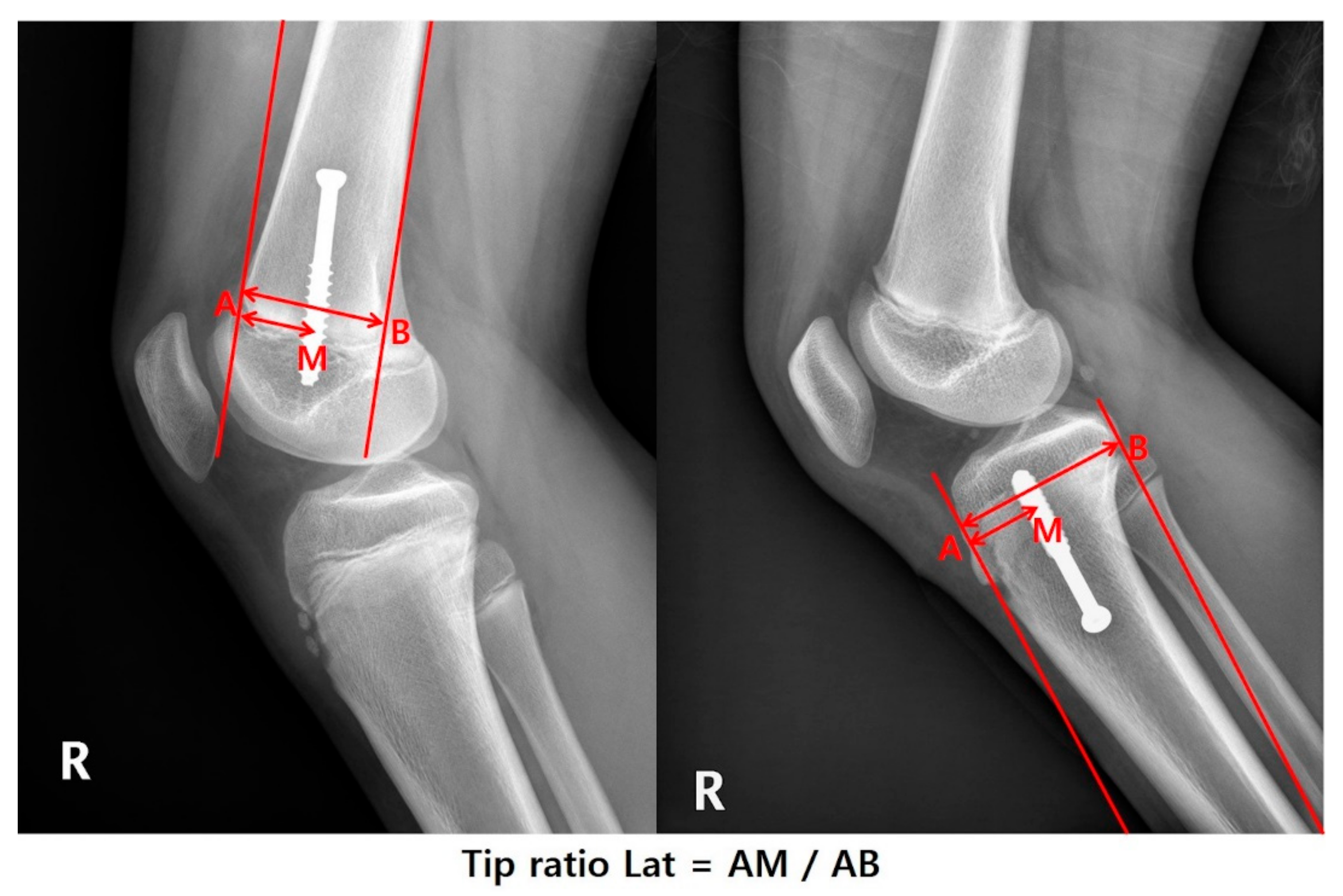 Jcm 09 04093 g002 Jcm 09 04093 g002
