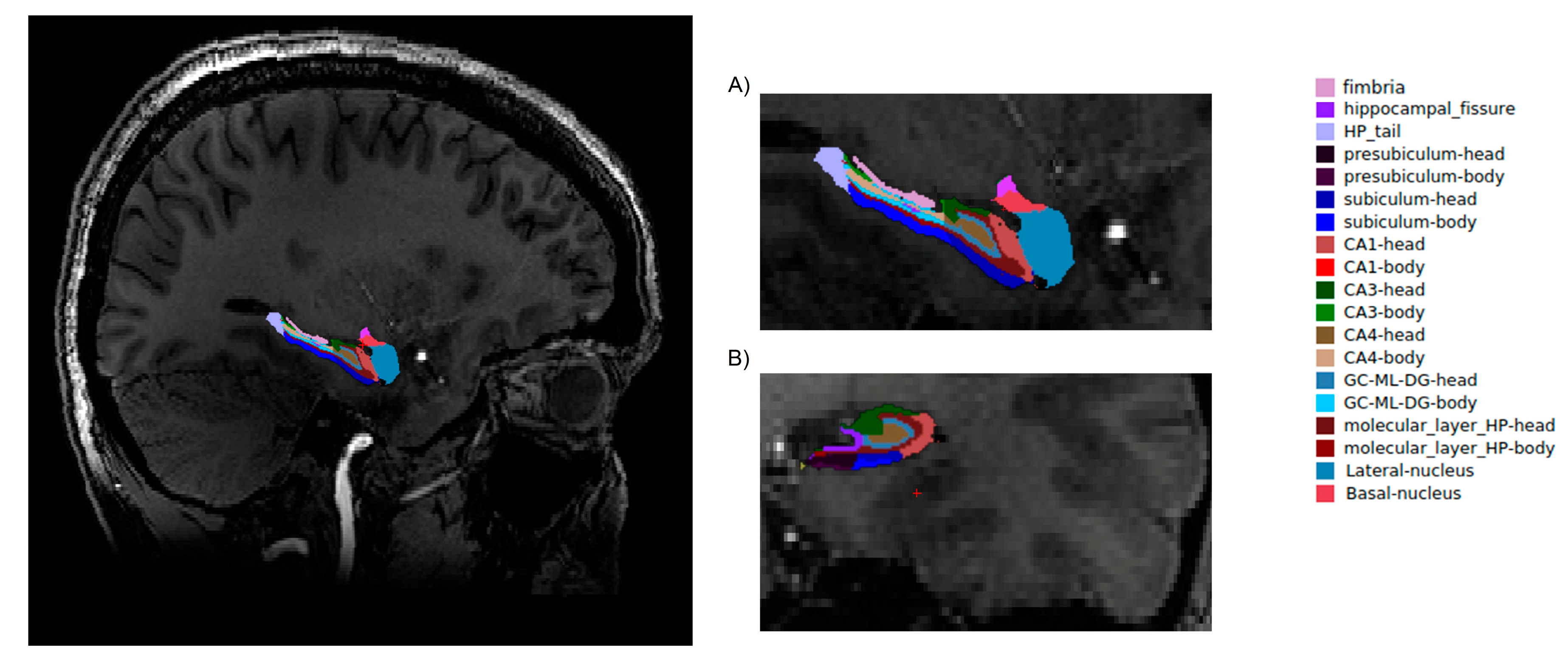 Jcm 10 00014 g001 Jcm 10 00014 g001