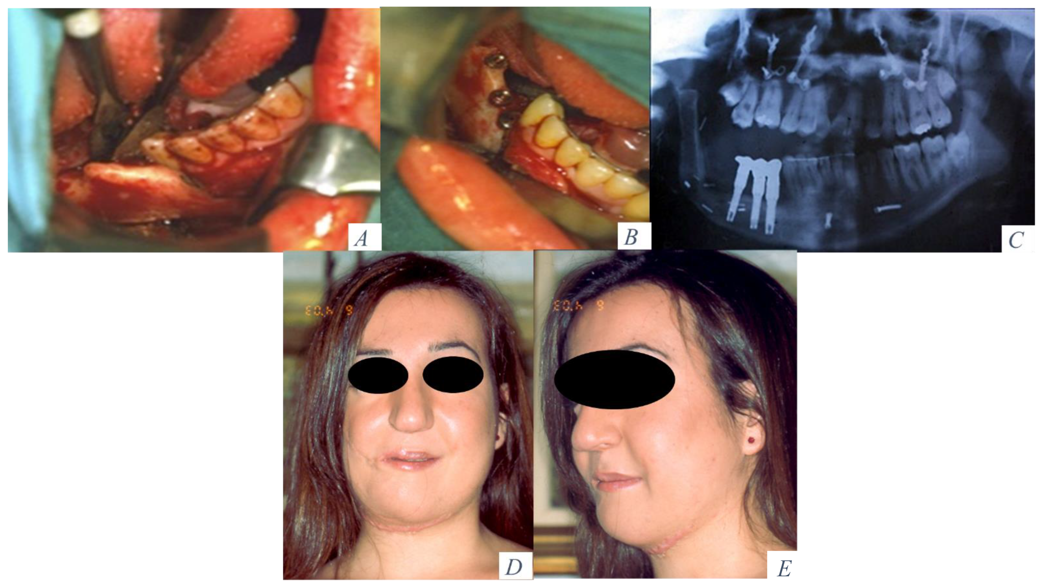 Jcm 10 00101 g004 550