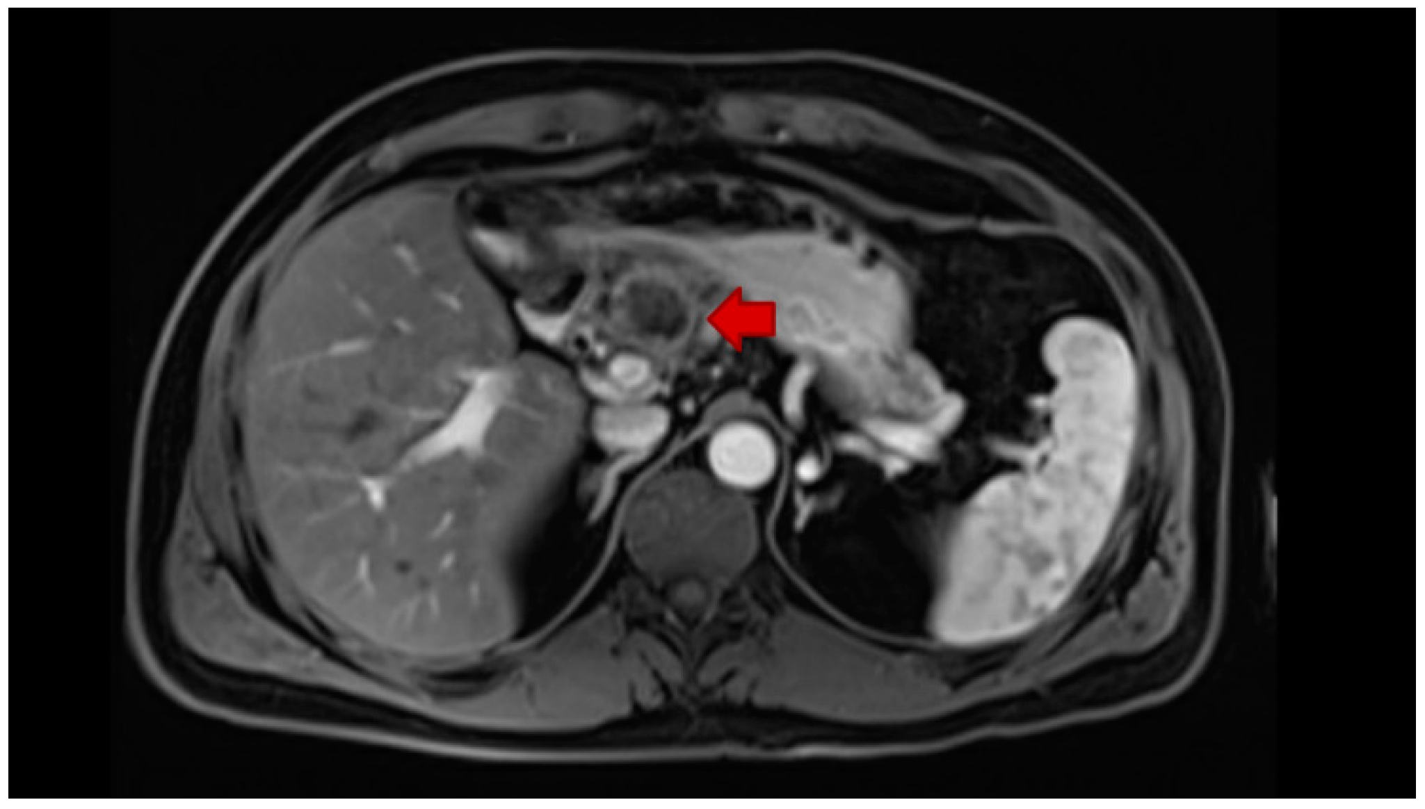 Jcm 10 00104 g002 Jcm 10 00104 g002