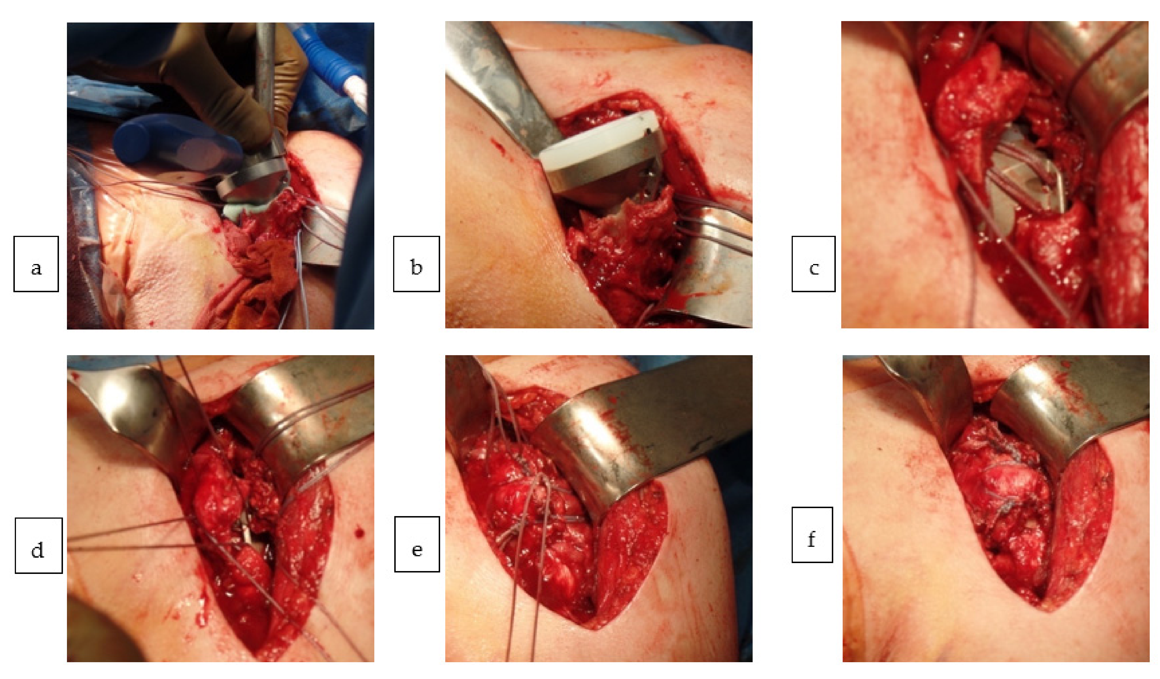 Jcm 10 00175 g002 Jcm 10 00175 g002