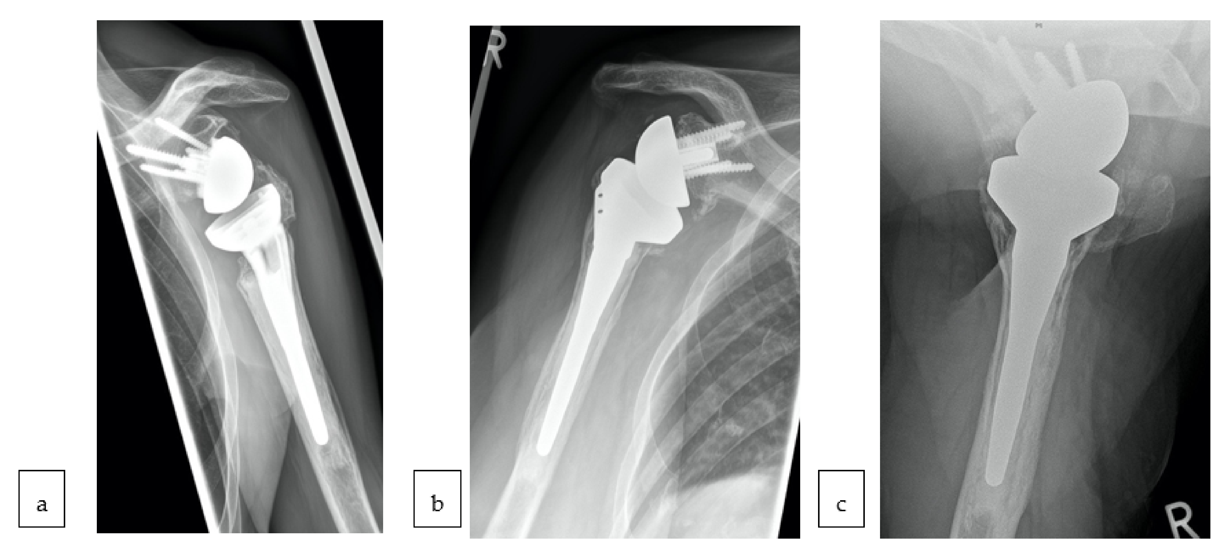 Jcm 10 00175 g003 Jcm 10 00175 g003