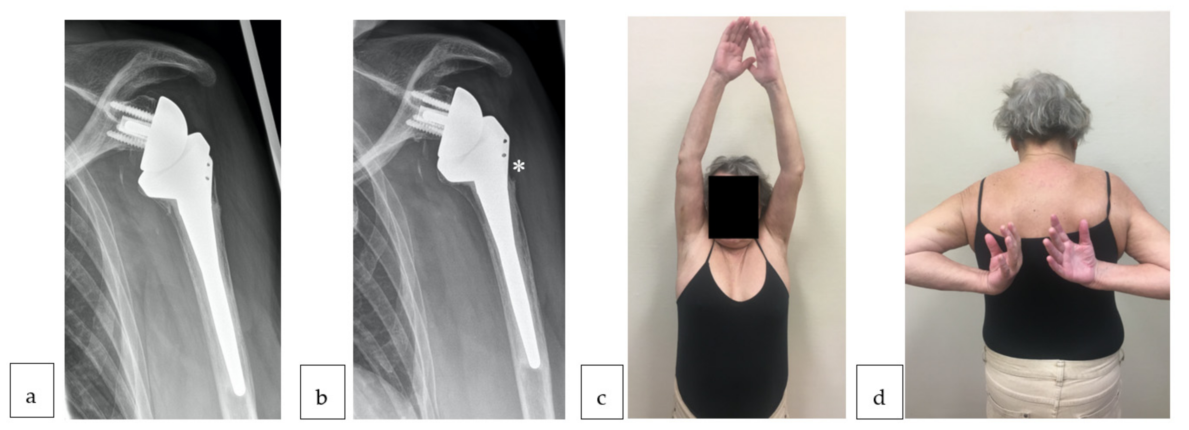 Jcm 10 00175 g006 Jcm 10 00175 g006