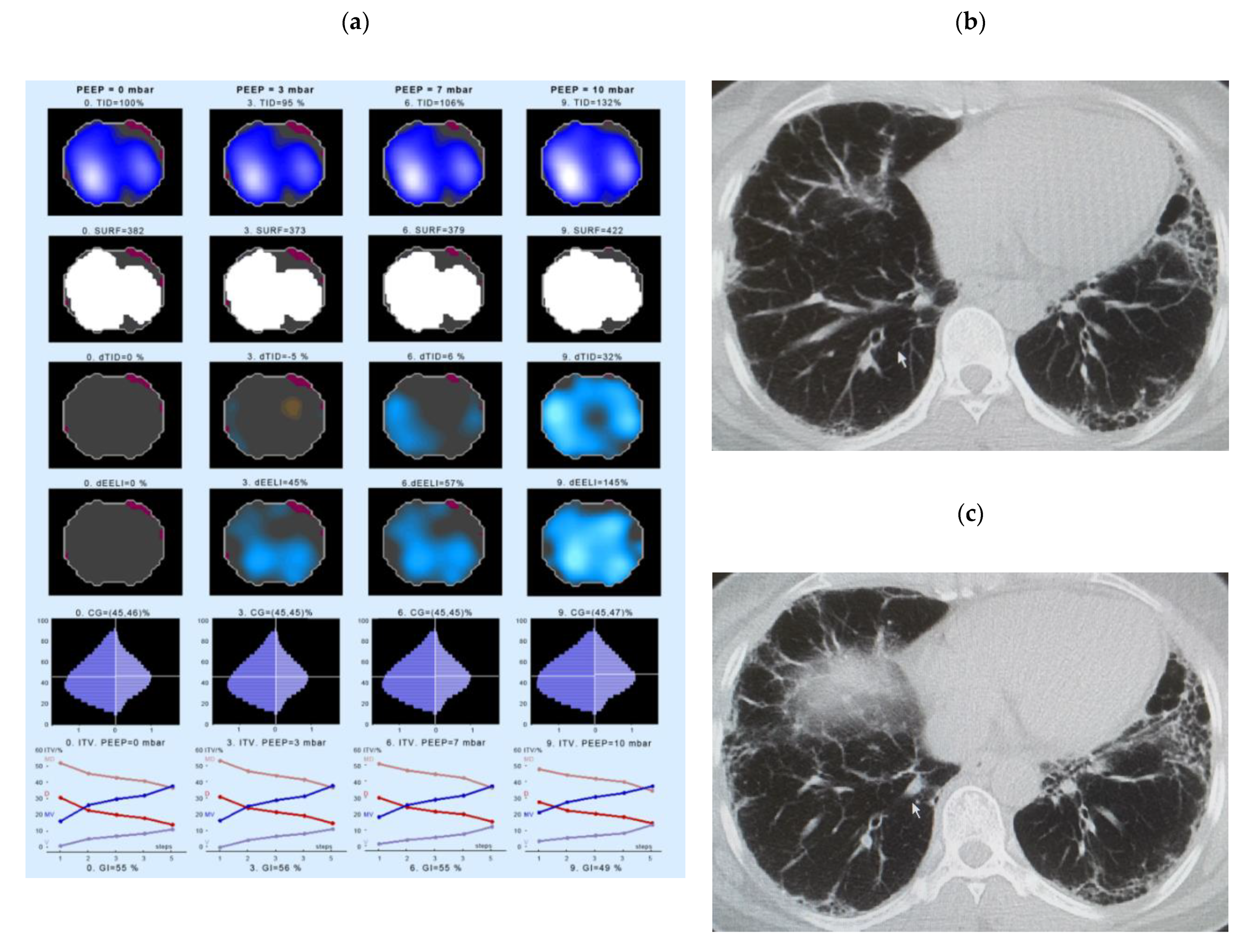 Jcm 10 00192 g003 Jcm 10 00192 g003