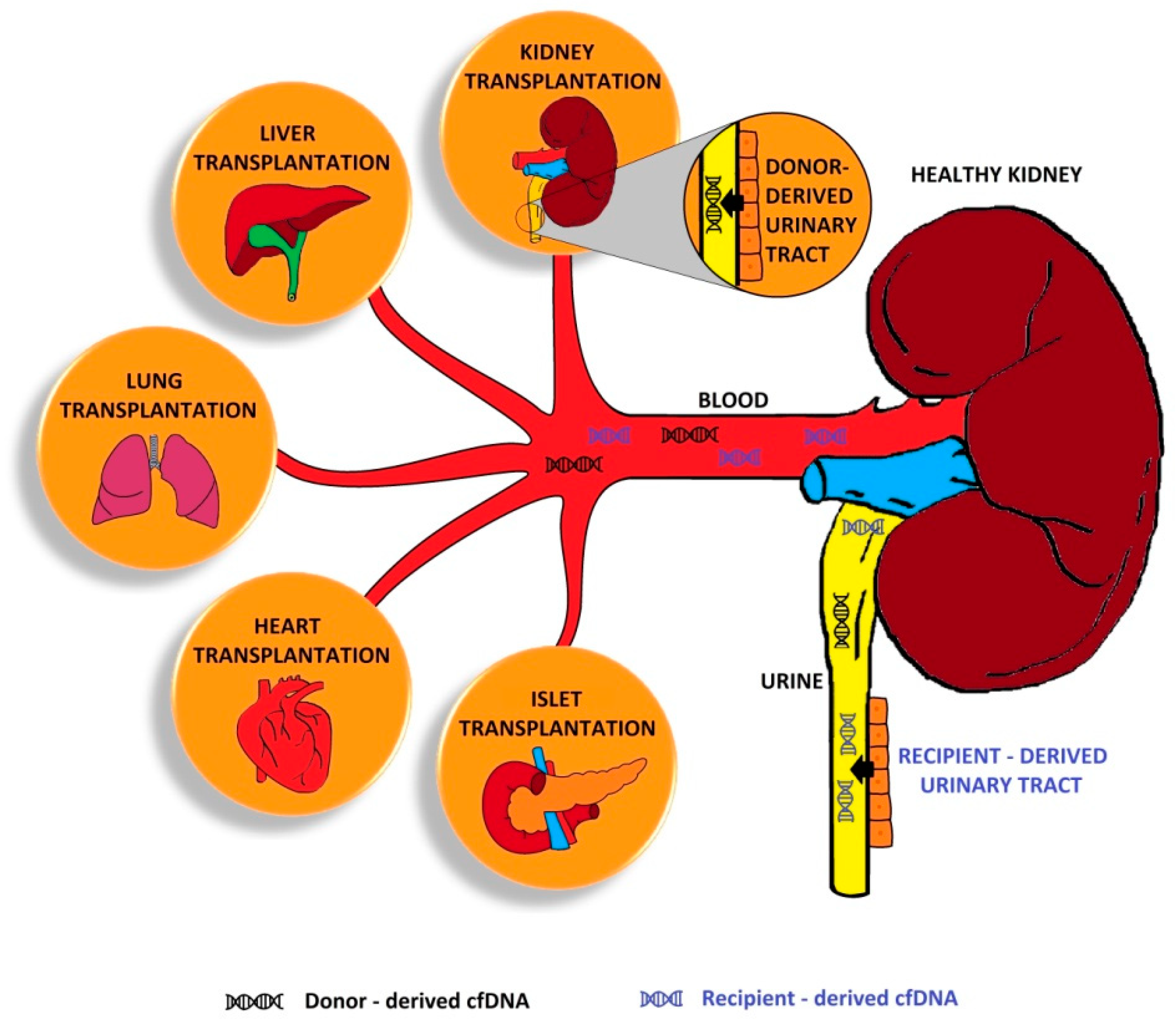 Kidney Transplant Donor kidney-transplant-donor