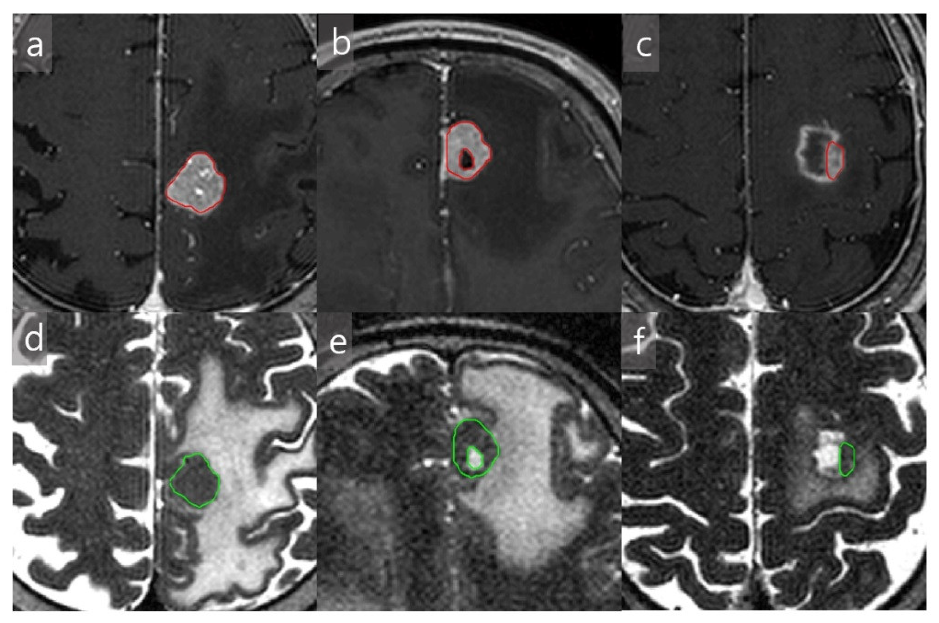Jcm 10 00237 g002 Jcm 10 00237 g002