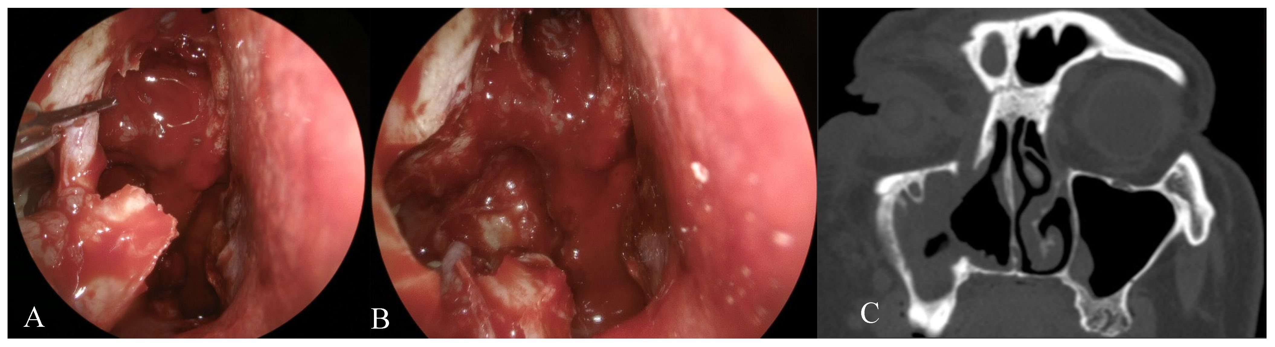 Jcm 10 00245 g001 Jcm 10 00245 g001