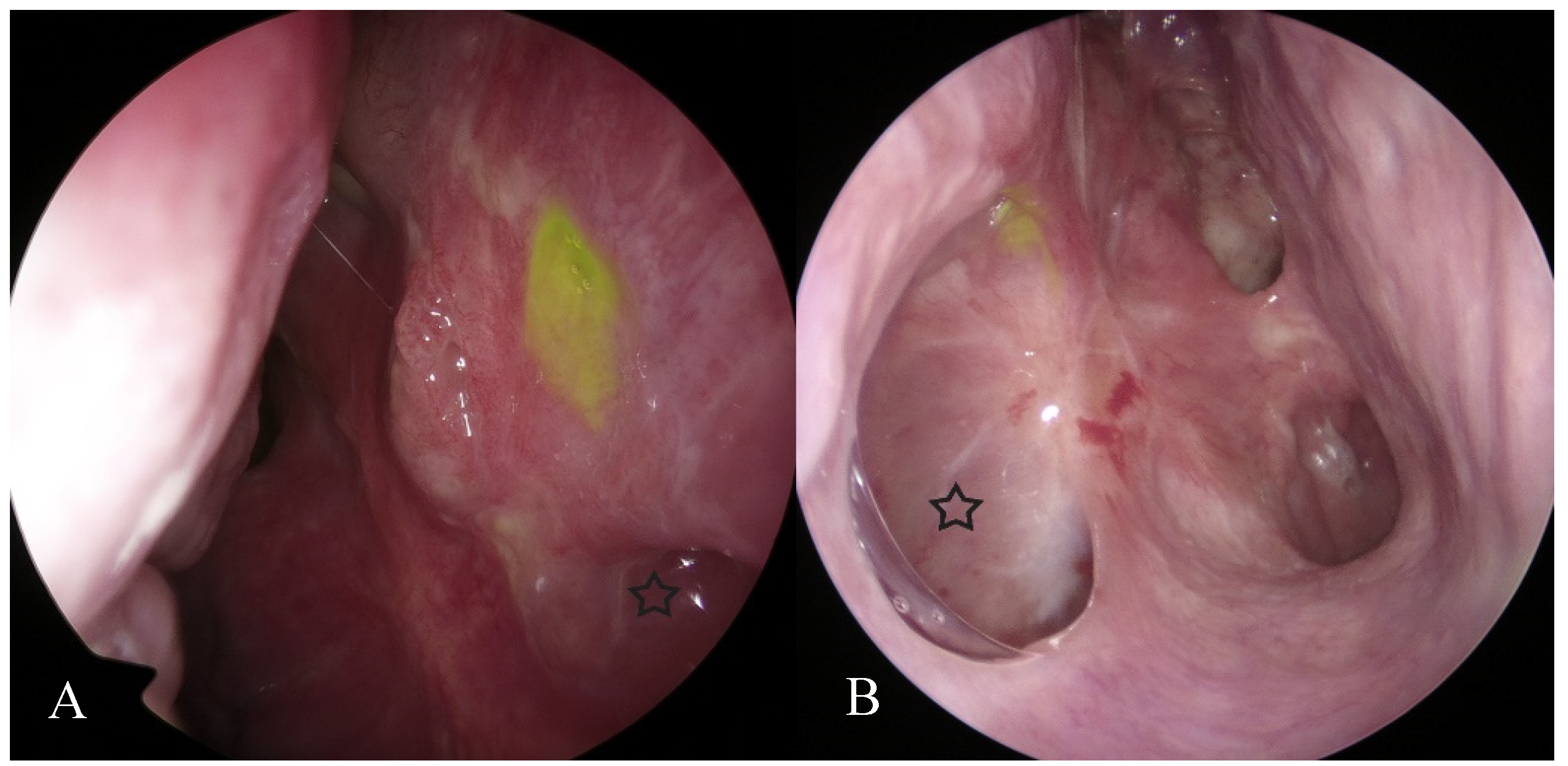 Jcm 10 00245 g002 Jcm 10 00245 g002