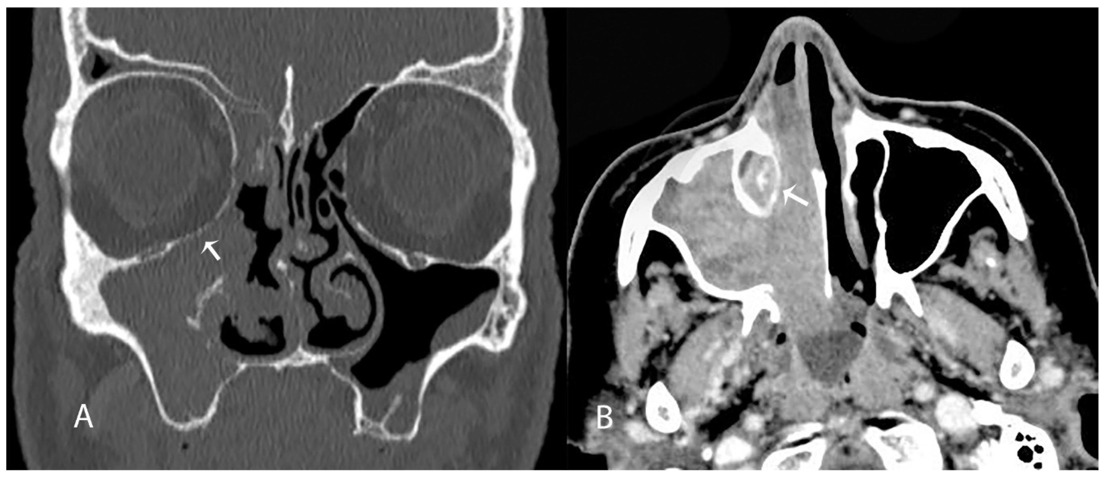 Jcm 10 00245 g004 Jcm 10 00245 g004
