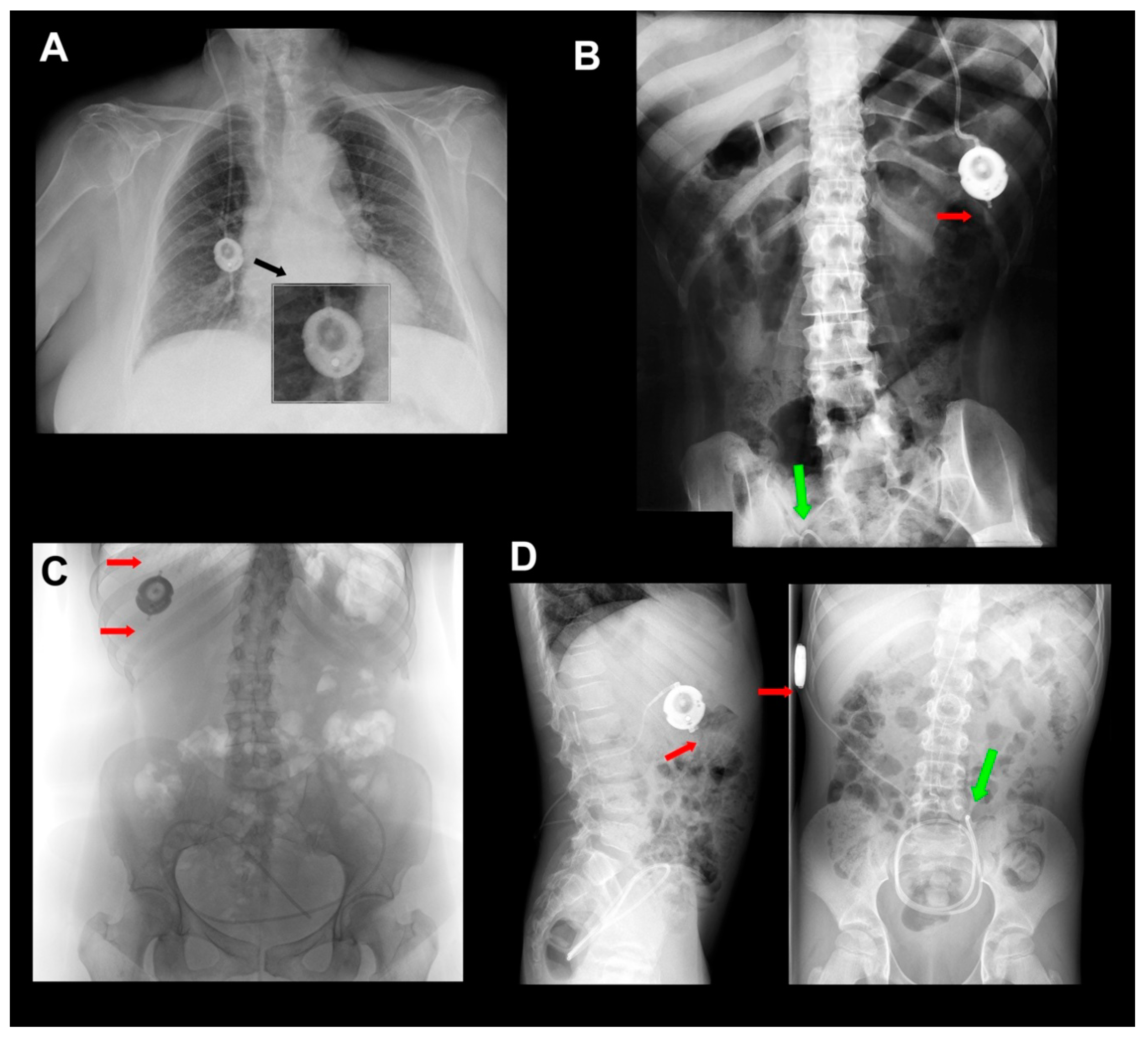 Jcm 10 00246 g004 Jcm 10 00246 g004