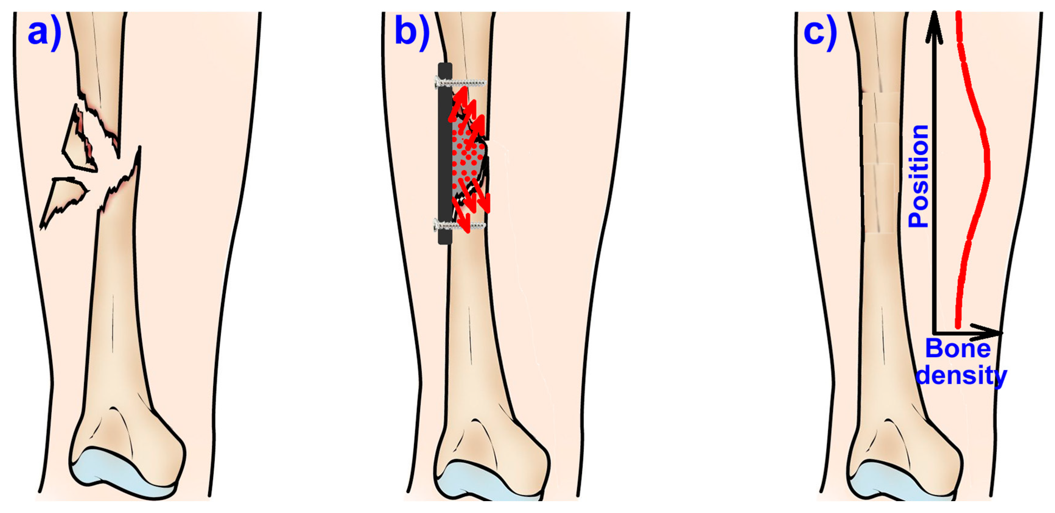 Jcm | Free Full-Text | Advances In Osteoporotic Bone Tissue Engineering |  Html