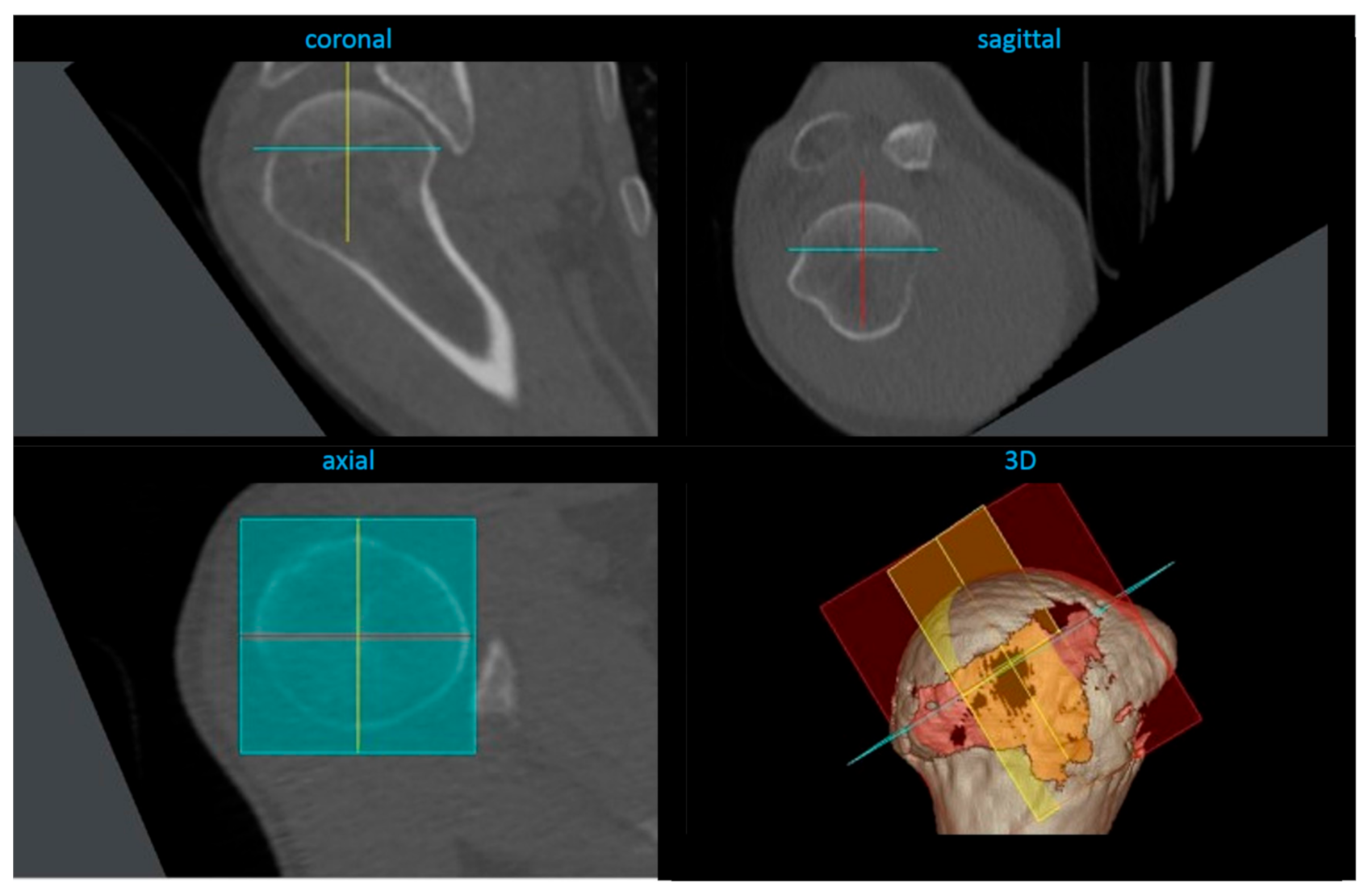 Jcm 10 00259 g003 Jcm 10 00259 g003