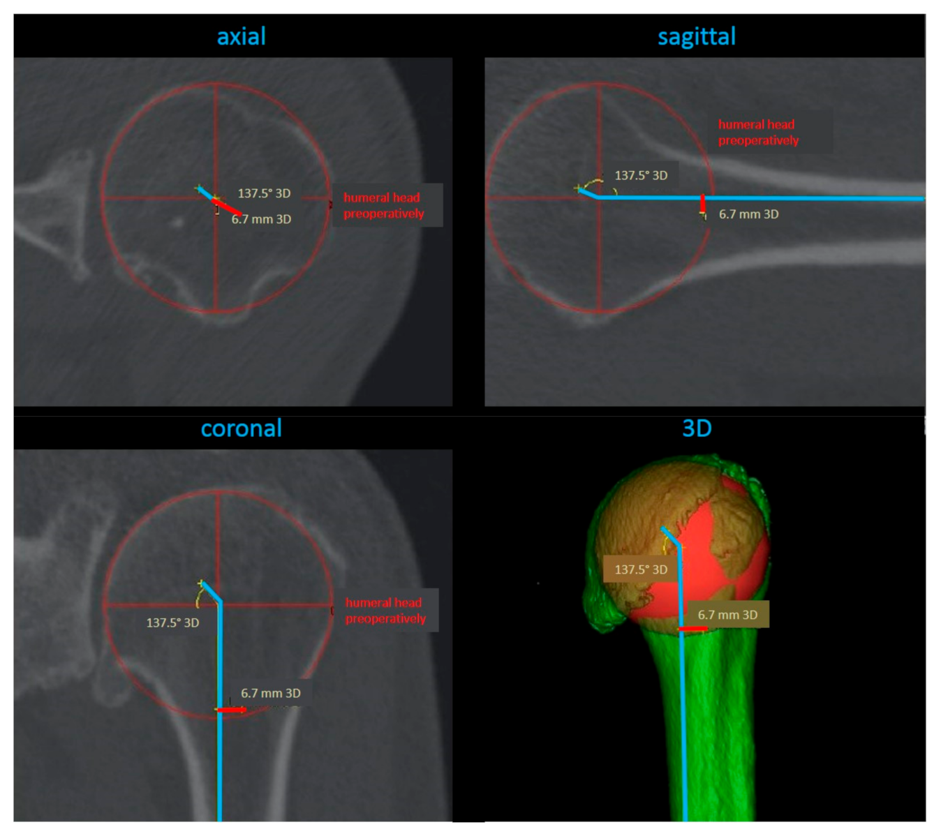Jcm 10 00259 g004 Jcm 10 00259 g004
