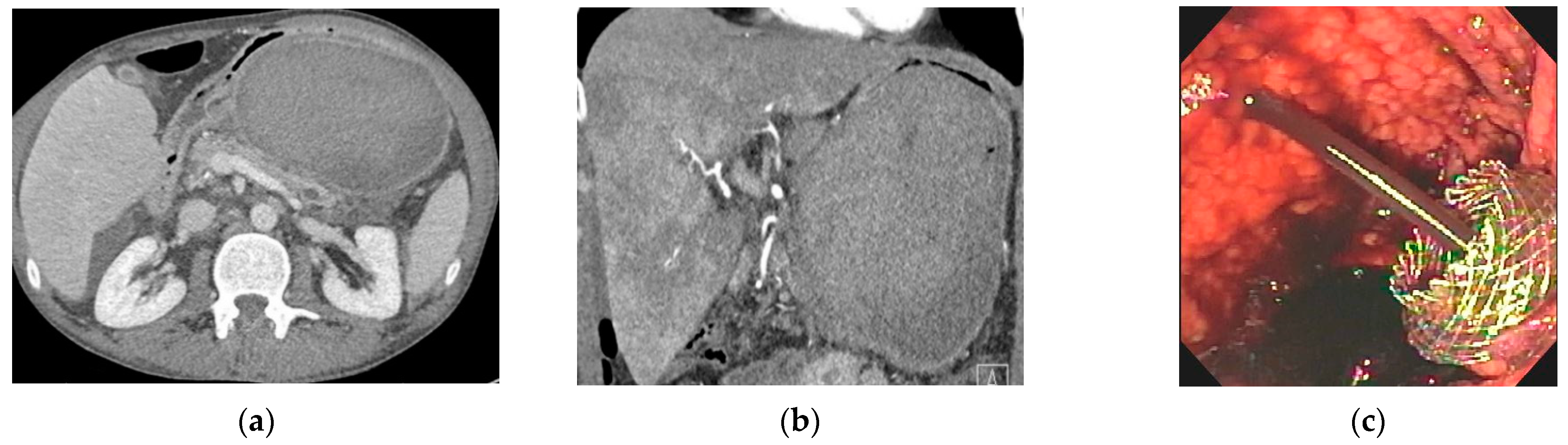 Jcm 10 00284 g003 Jcm 10 00284 g003