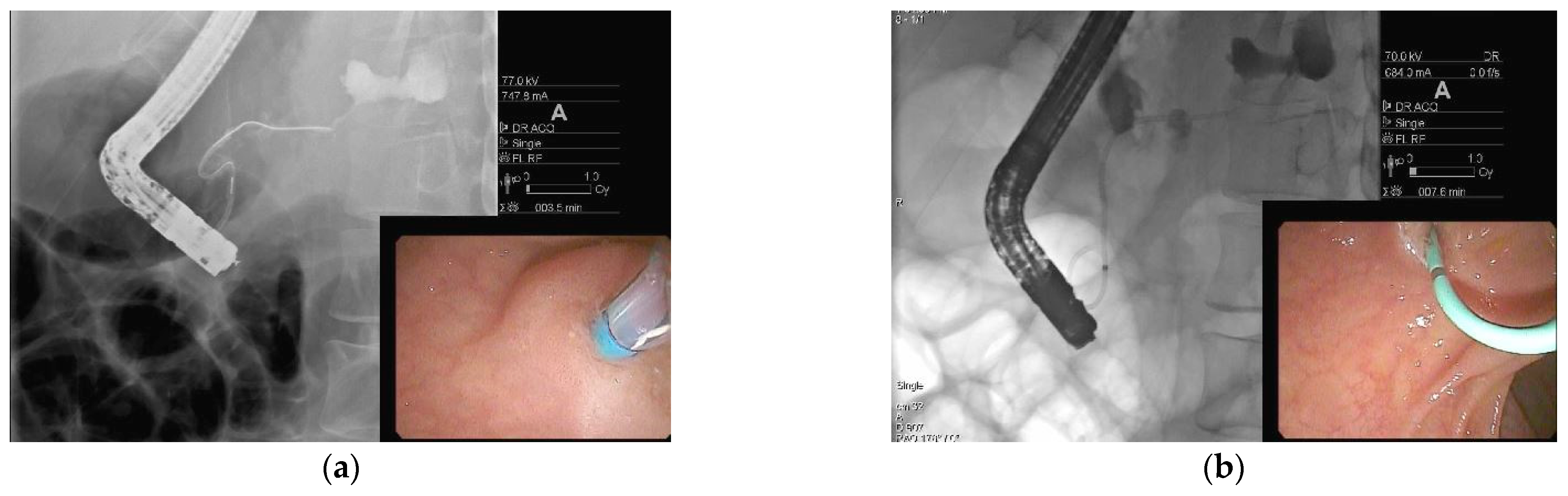 Jcm 10 00284 g005 Jcm 10 00284 g005