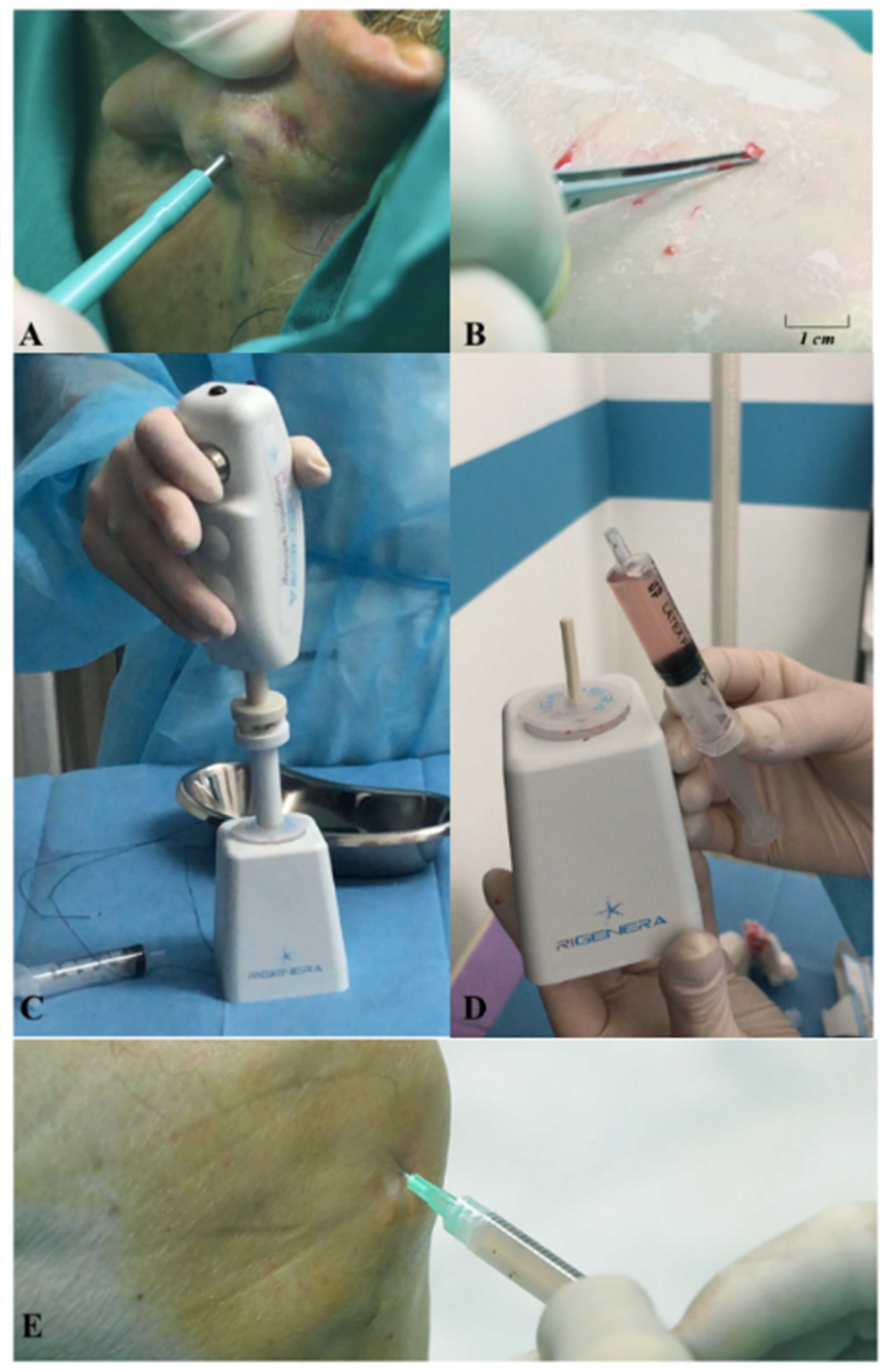 Jcm 10 00322 g001 Jcm 10 00322 g001