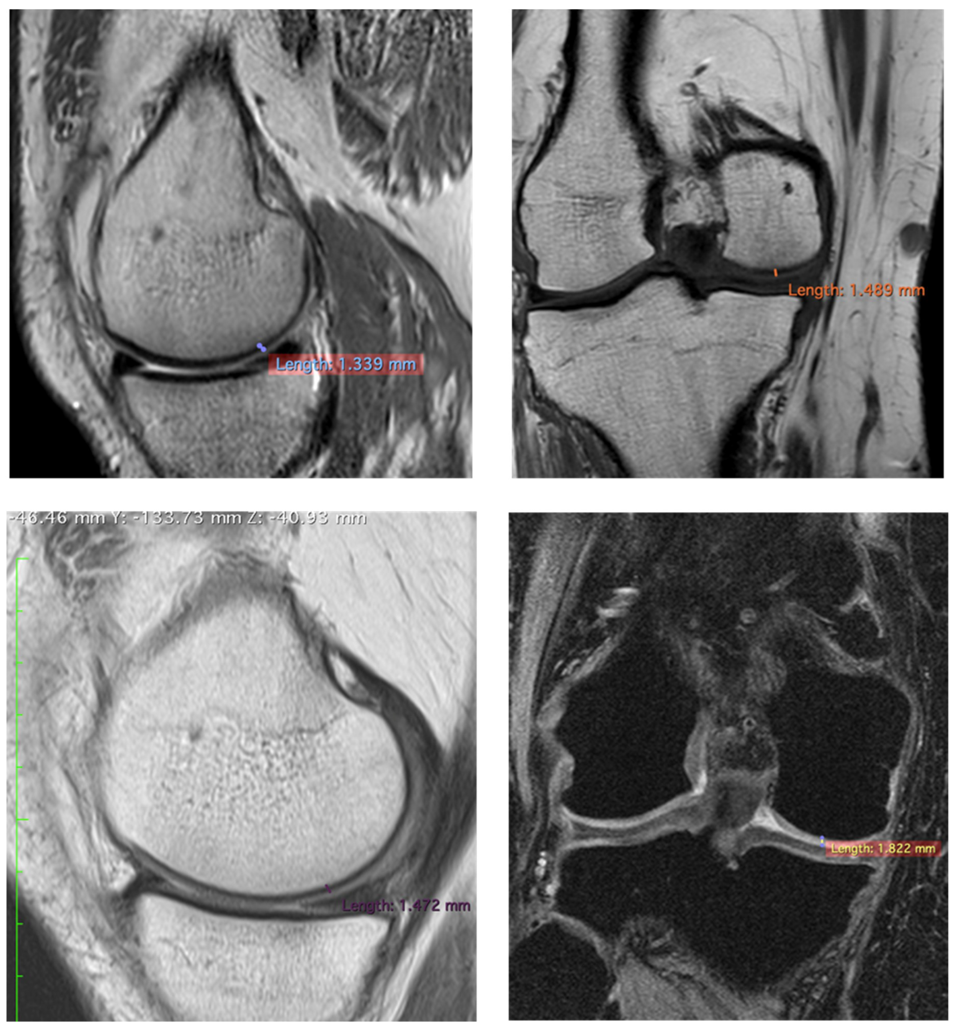 Jcm 10 00322 g003 Jcm 10 00322 g003