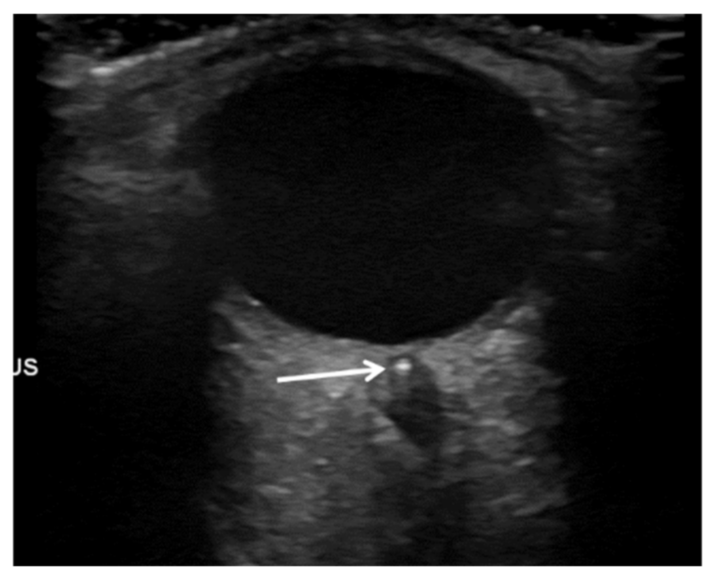 Jcm 10 00338 g002 Jcm 10 00338 g002