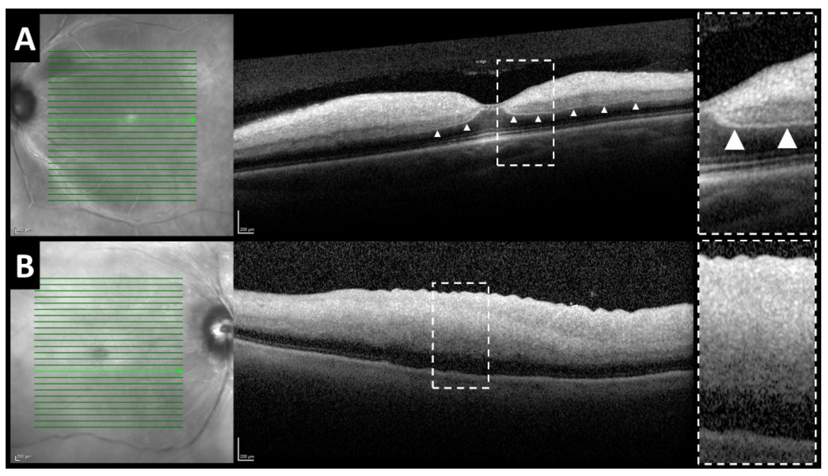 Jcm 10 00338 g003 Jcm 10 00338 g003