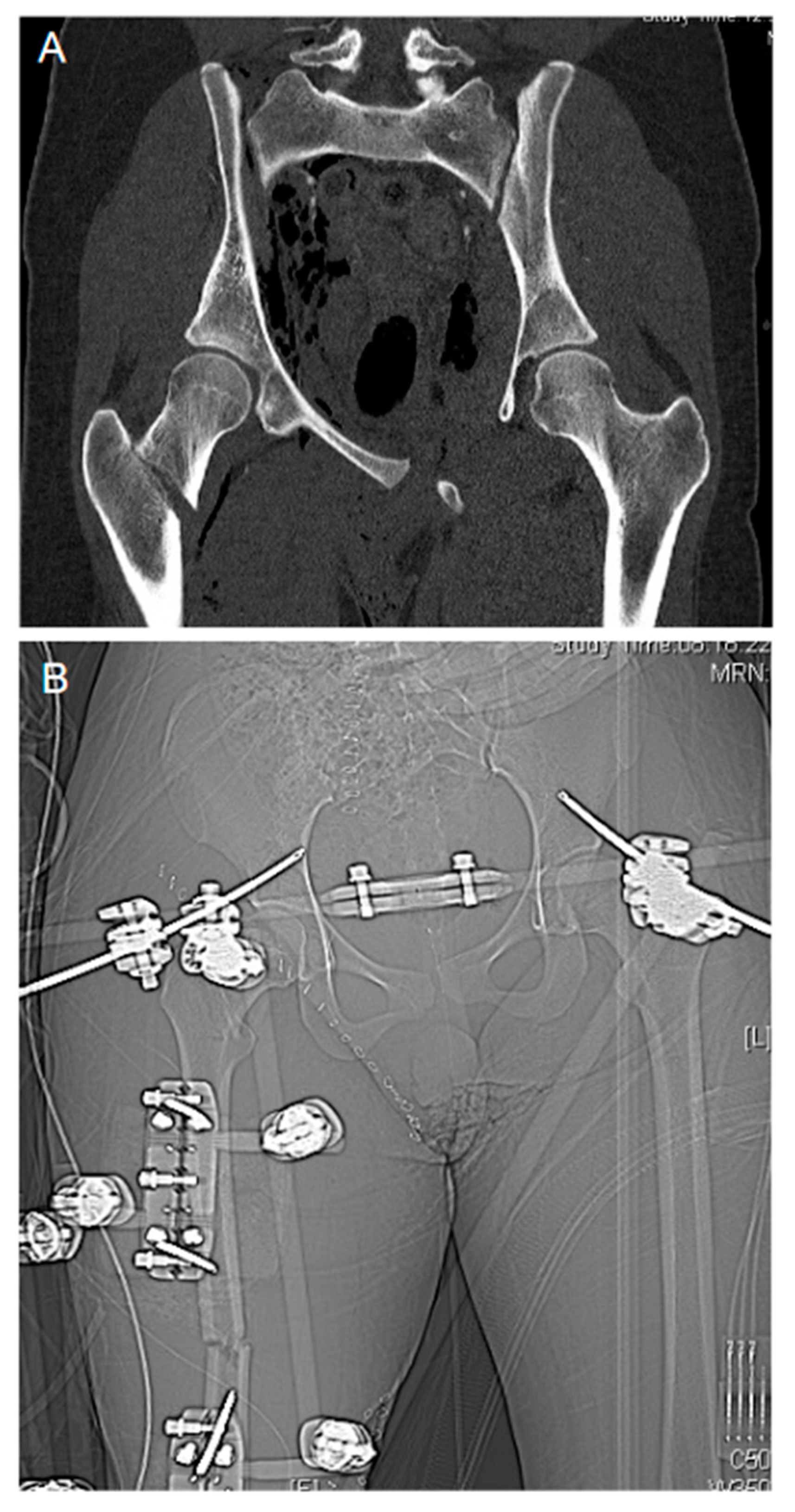 Jcm 10 00362 g002 Jcm 10 00362 g002