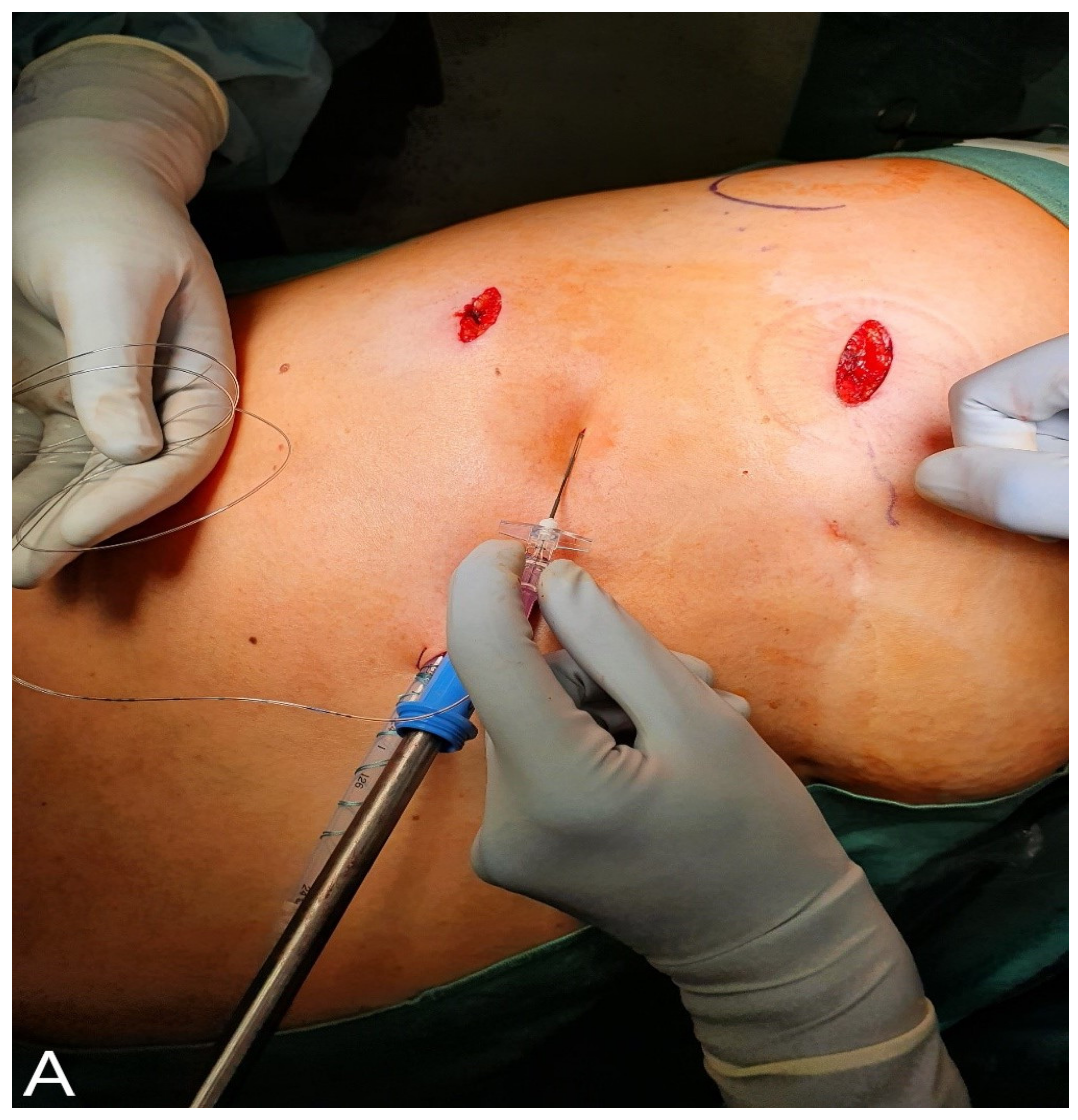 Jcm 10 00372 g001a Jcm 10 00372 g001a