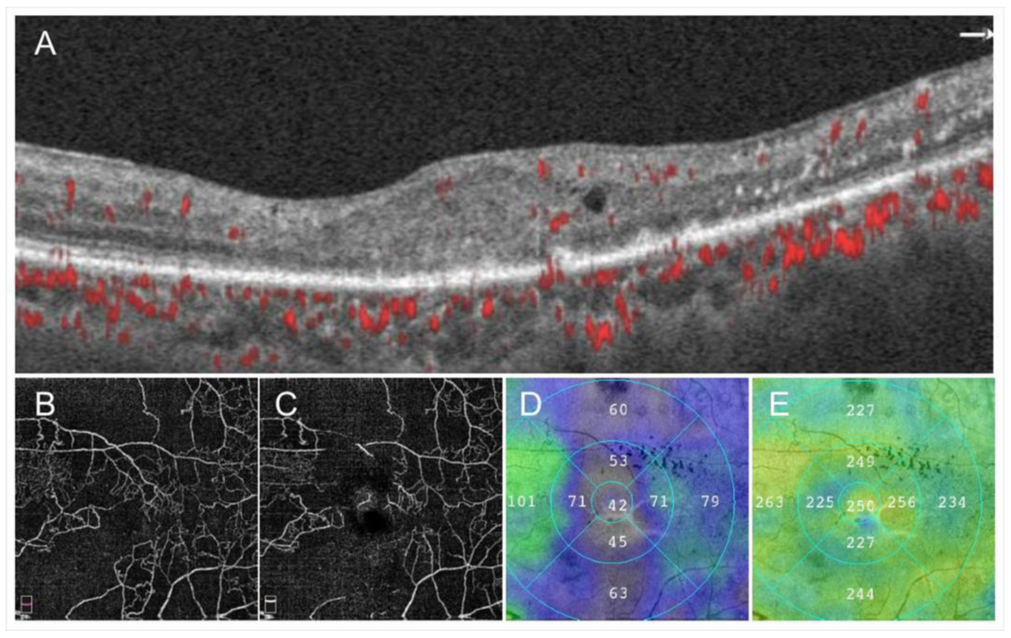 Jcm 10 00405 g004 Jcm 10 00405 g004