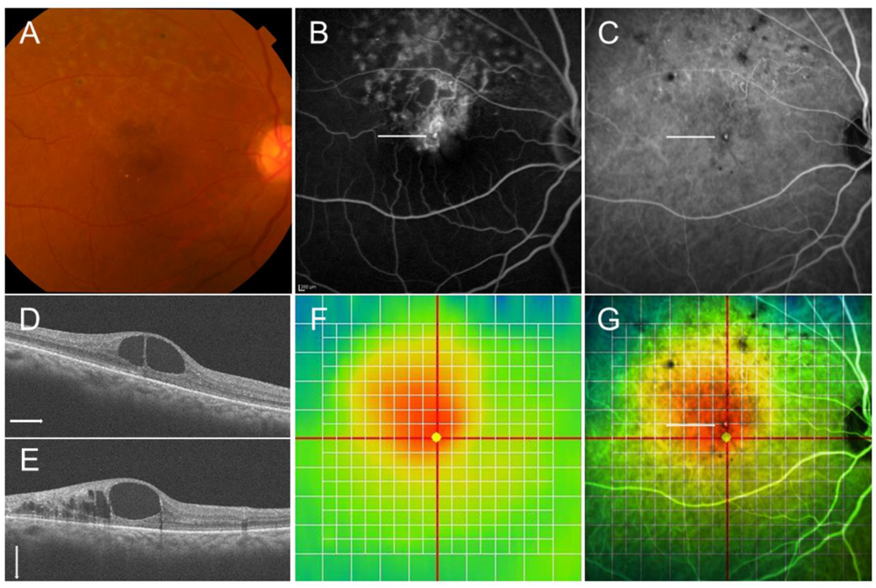 Jcm 10 00405 g006 Jcm 10 00405 g006