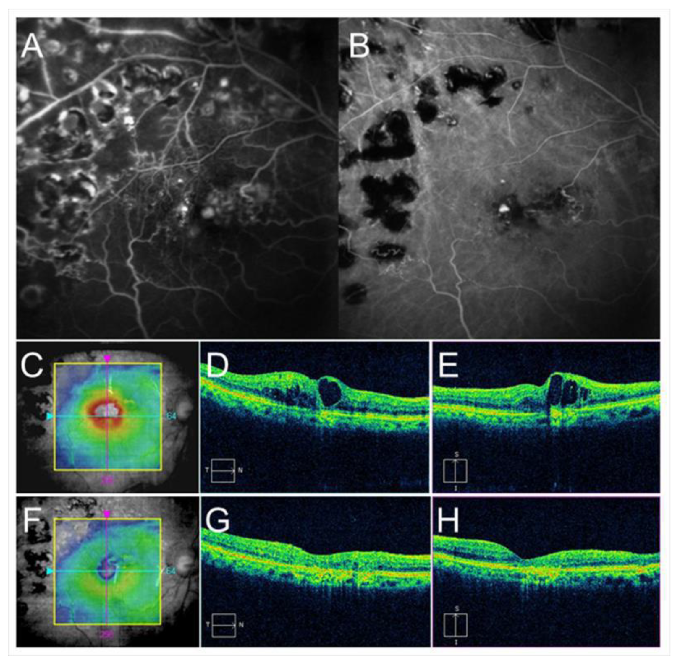 Jcm 10 00405 g007 Jcm 10 00405 g007
