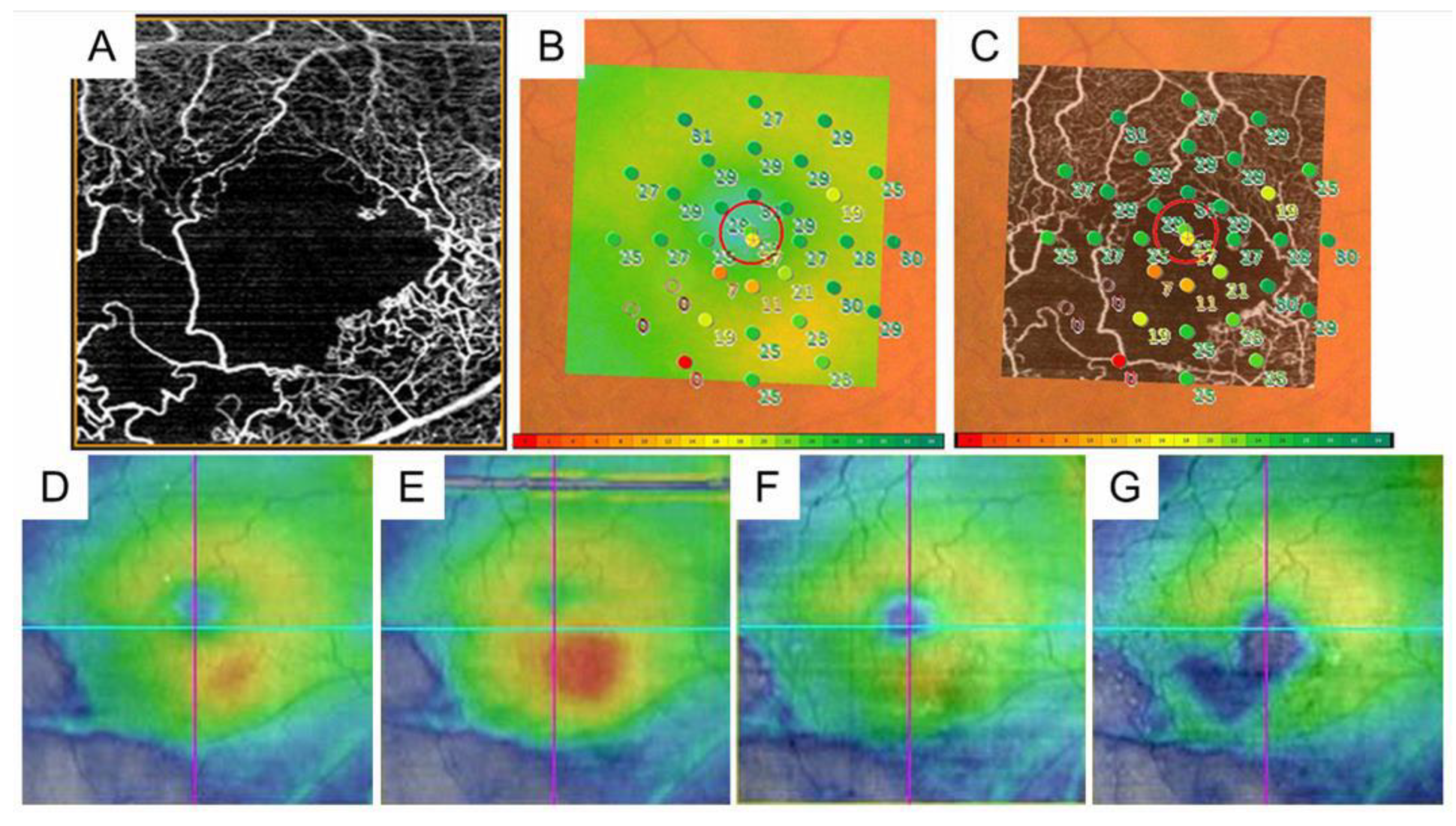 Jcm 10 00405 g011 Jcm 10 00405 g011