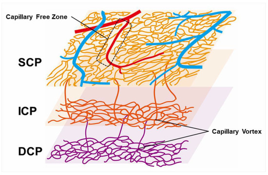Jcm Free Full Text Multimodal Imaging Of Microvascular Abnormalities In Retinal Vein Occlusion Html Jcm Free Full Text Multimodal Imaging Of Microvascular Abnormalities In Retinal Vein Occlusion Html
