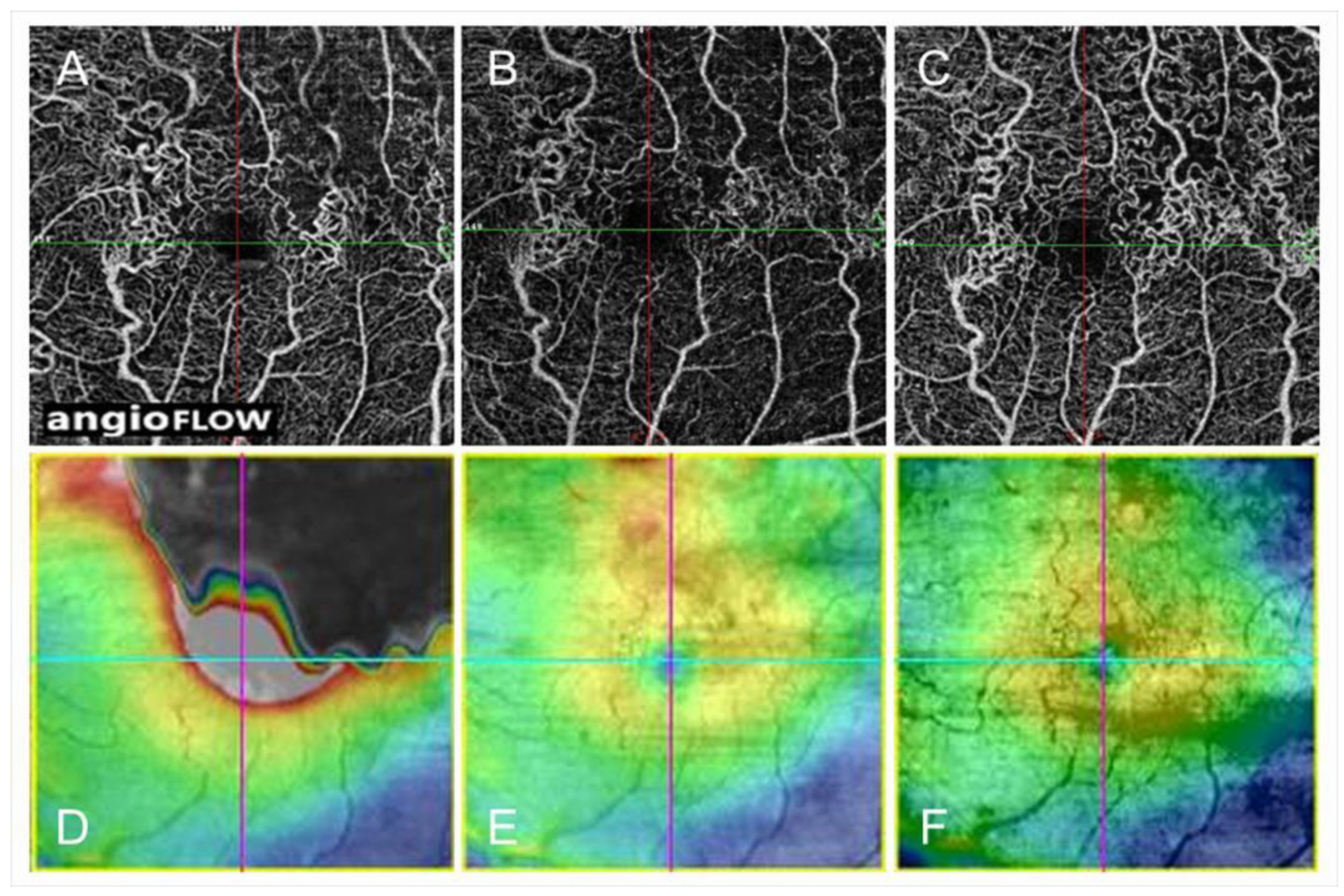 Jcm 10 00405 g014 Jcm 10 00405 g014