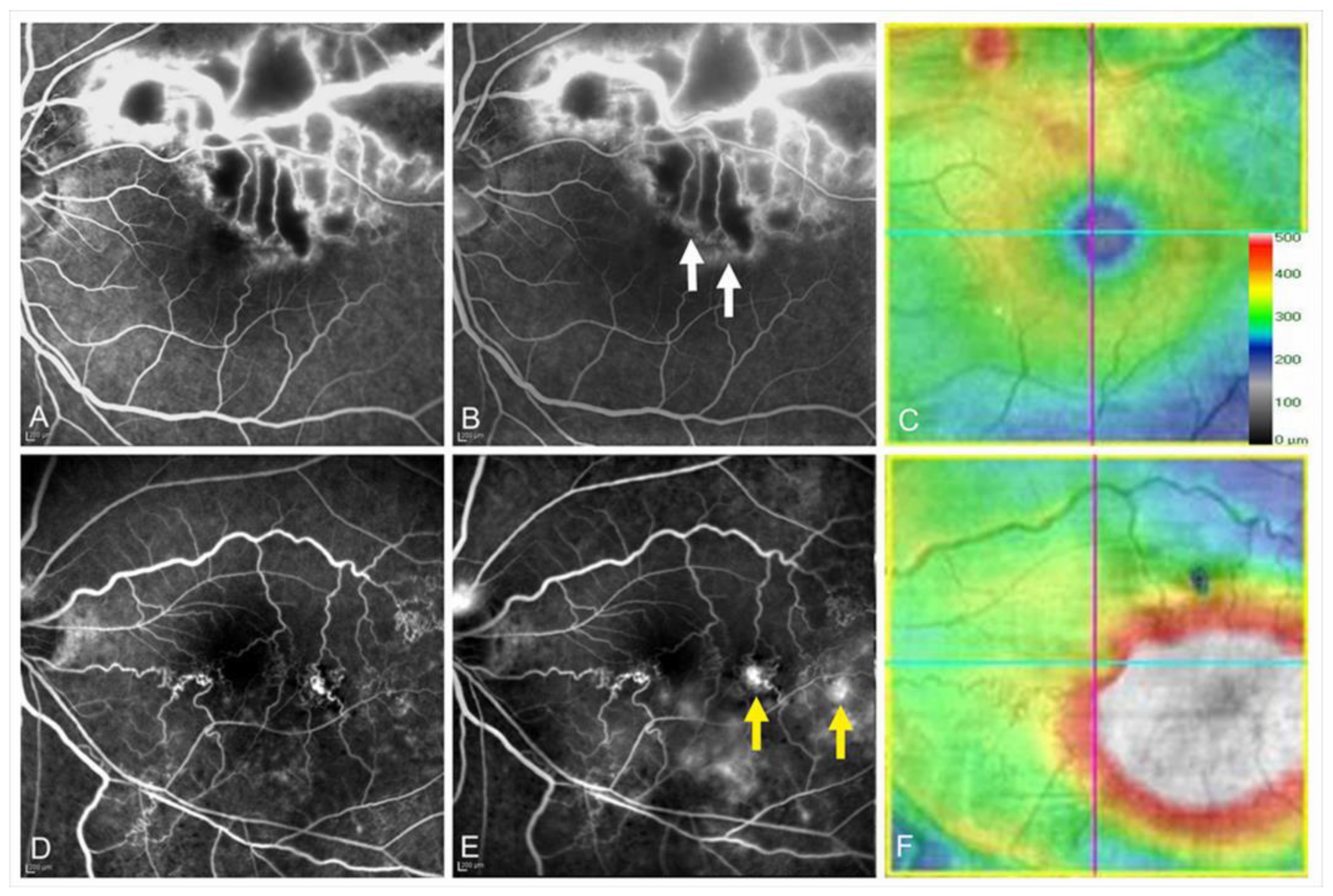 Jcm 10 00405 g015 Jcm 10 00405 g015