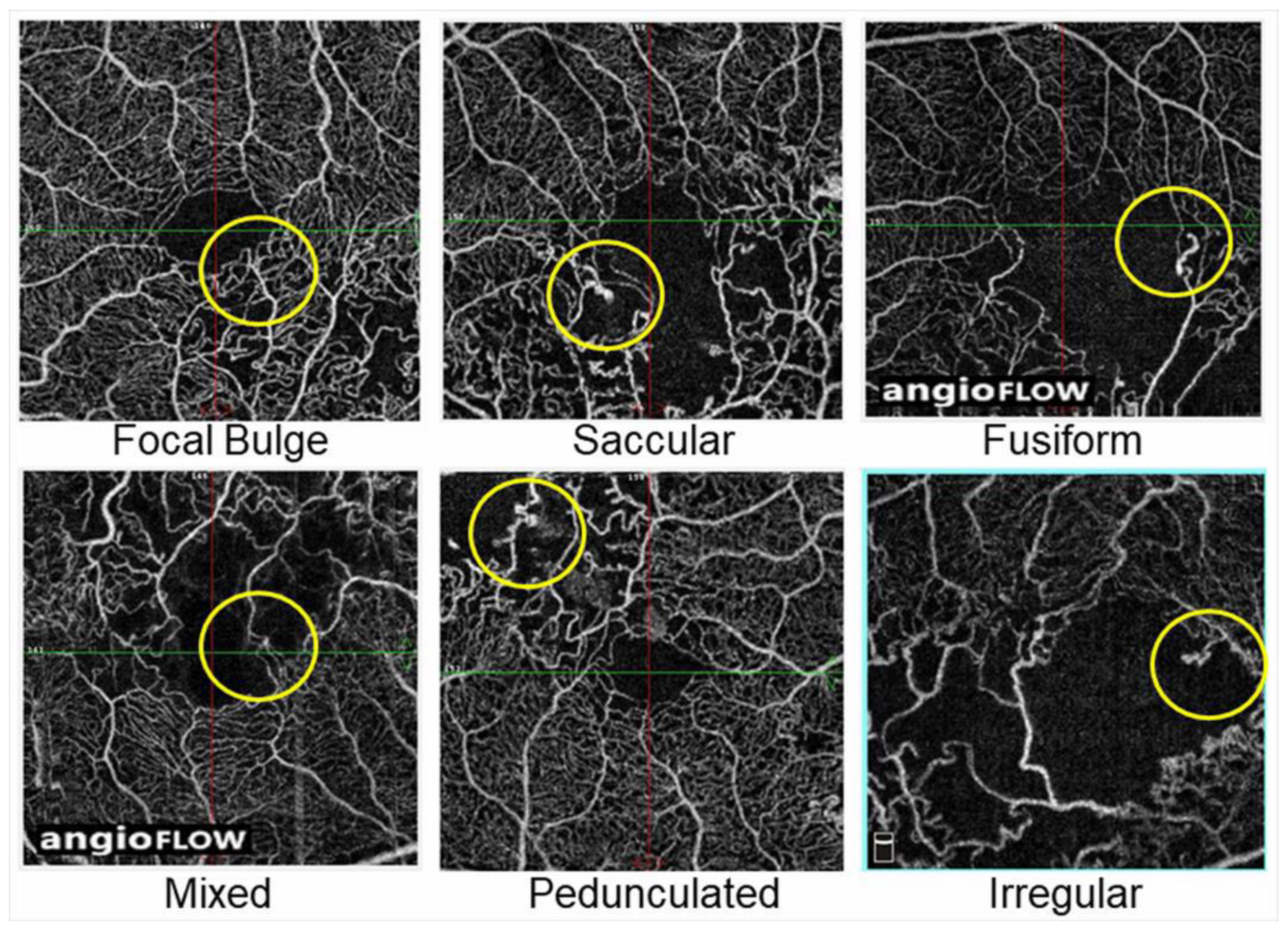 Jcm 10 00405 g018 Jcm 10 00405 g018