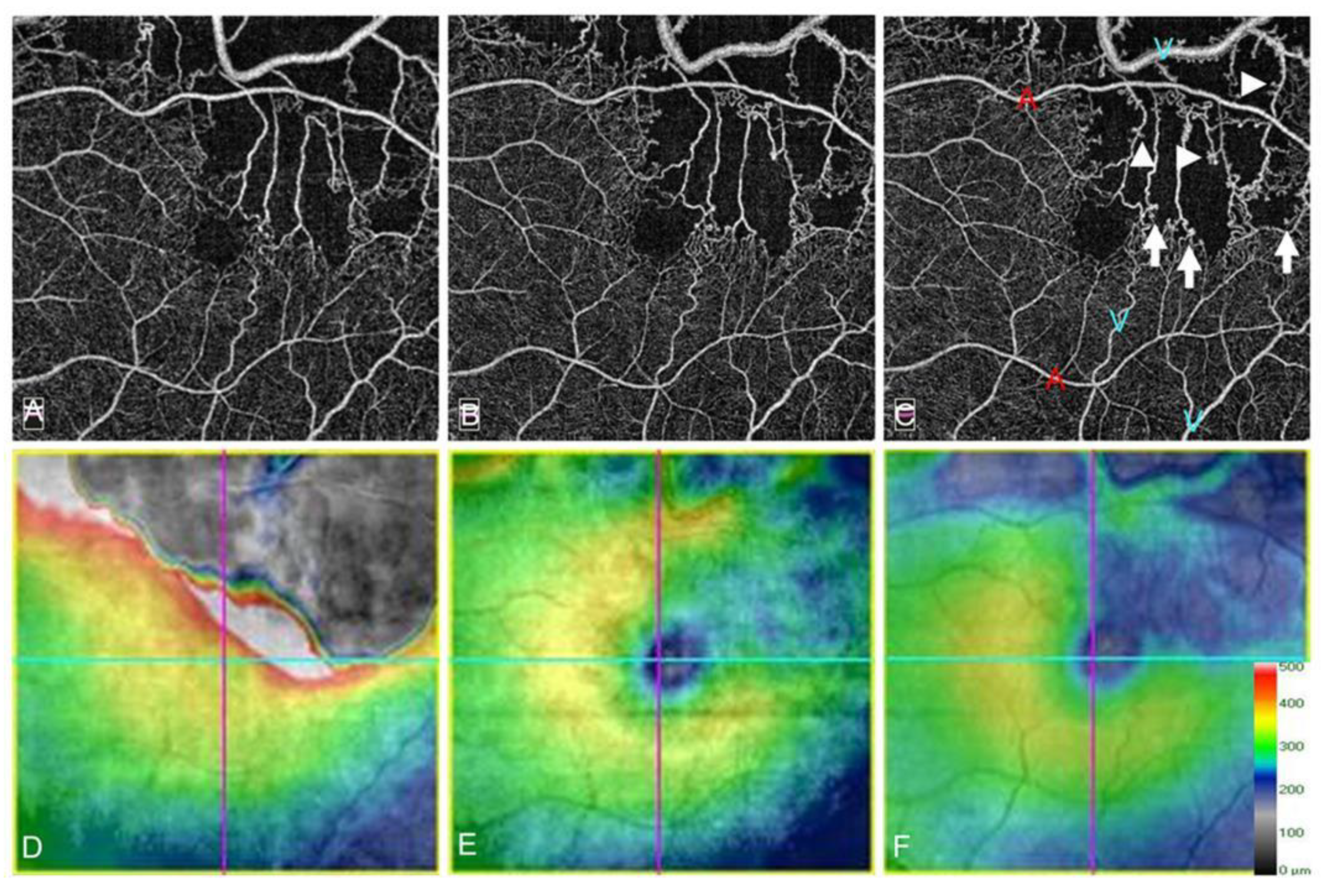 Jcm 10 00405 g019 Jcm 10 00405 g019