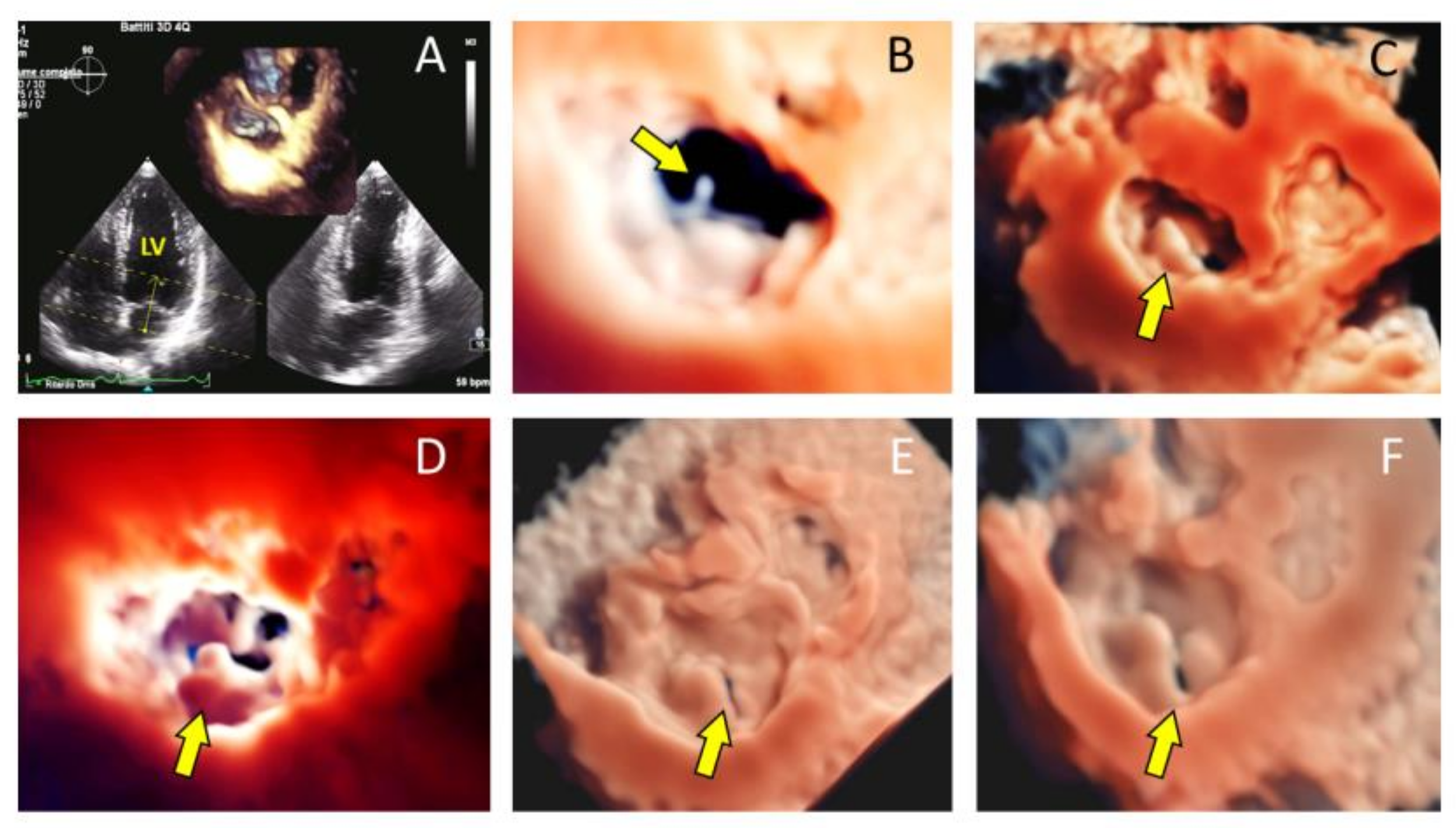 Jcm 10 00408 g001 Jcm 10 00408 g001