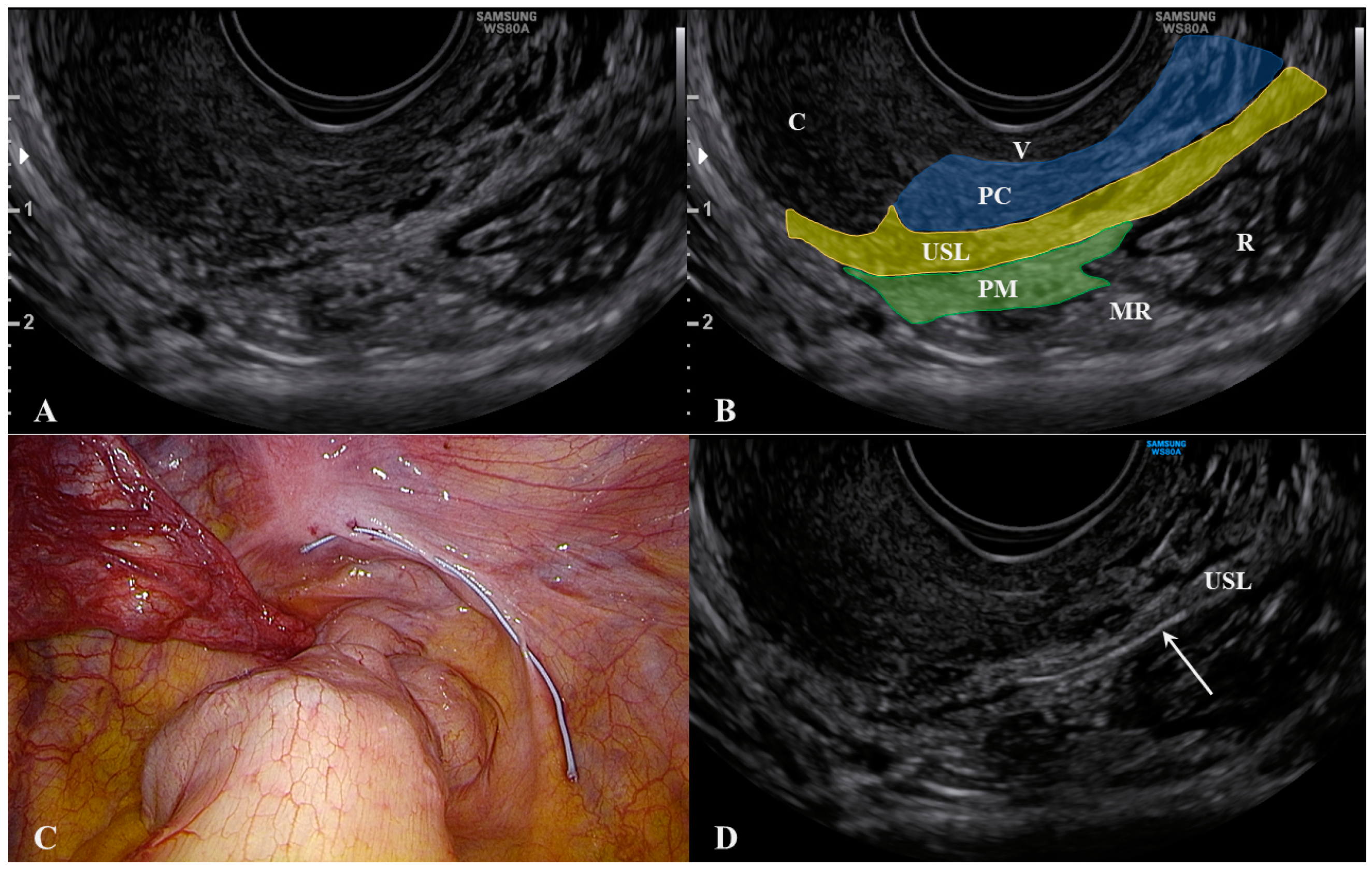 Jcm 10 00437 g002 Jcm 10 00437 g002