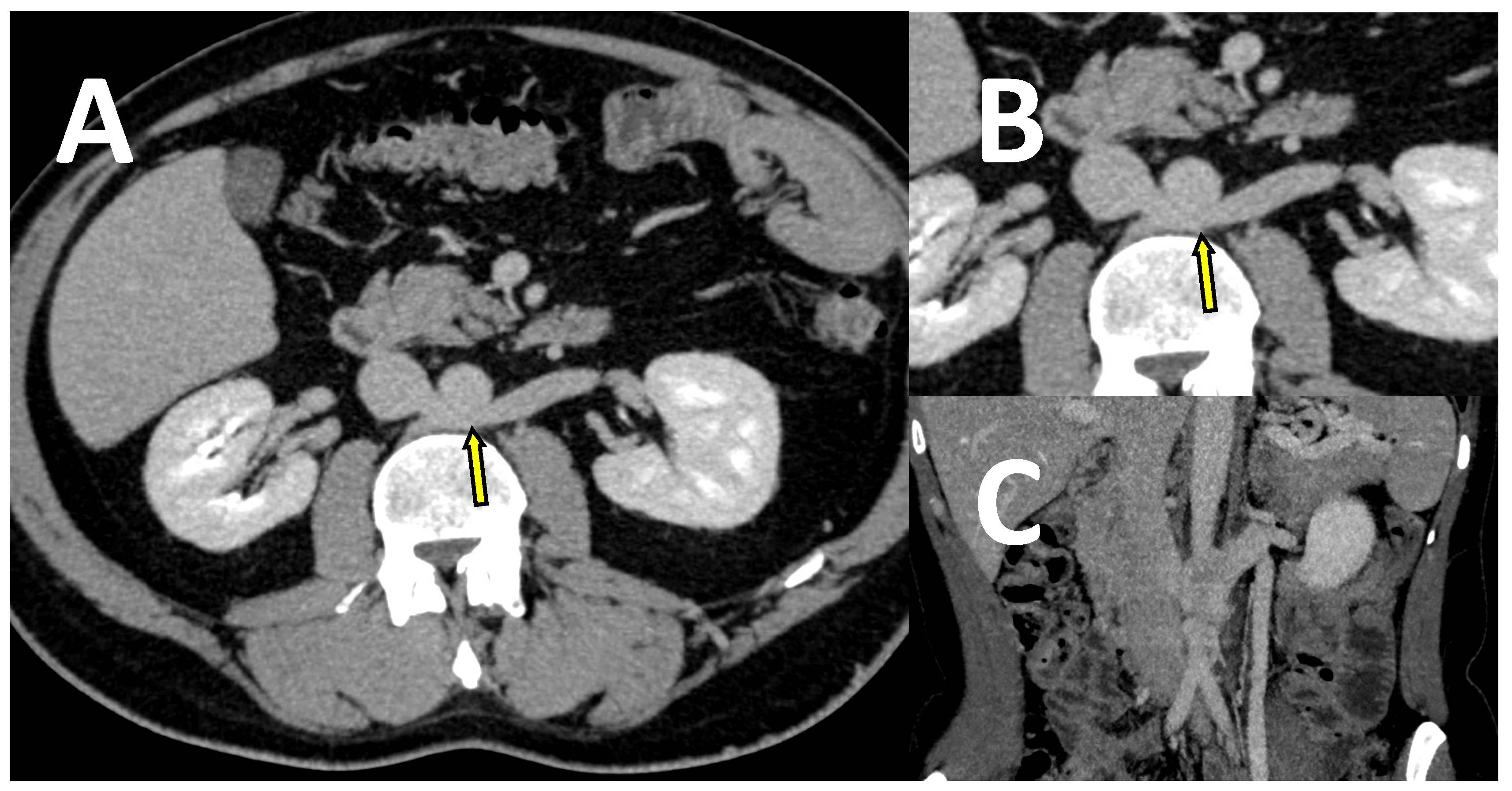 Jcm 10 00455 g005 Jcm 10 00455 g005