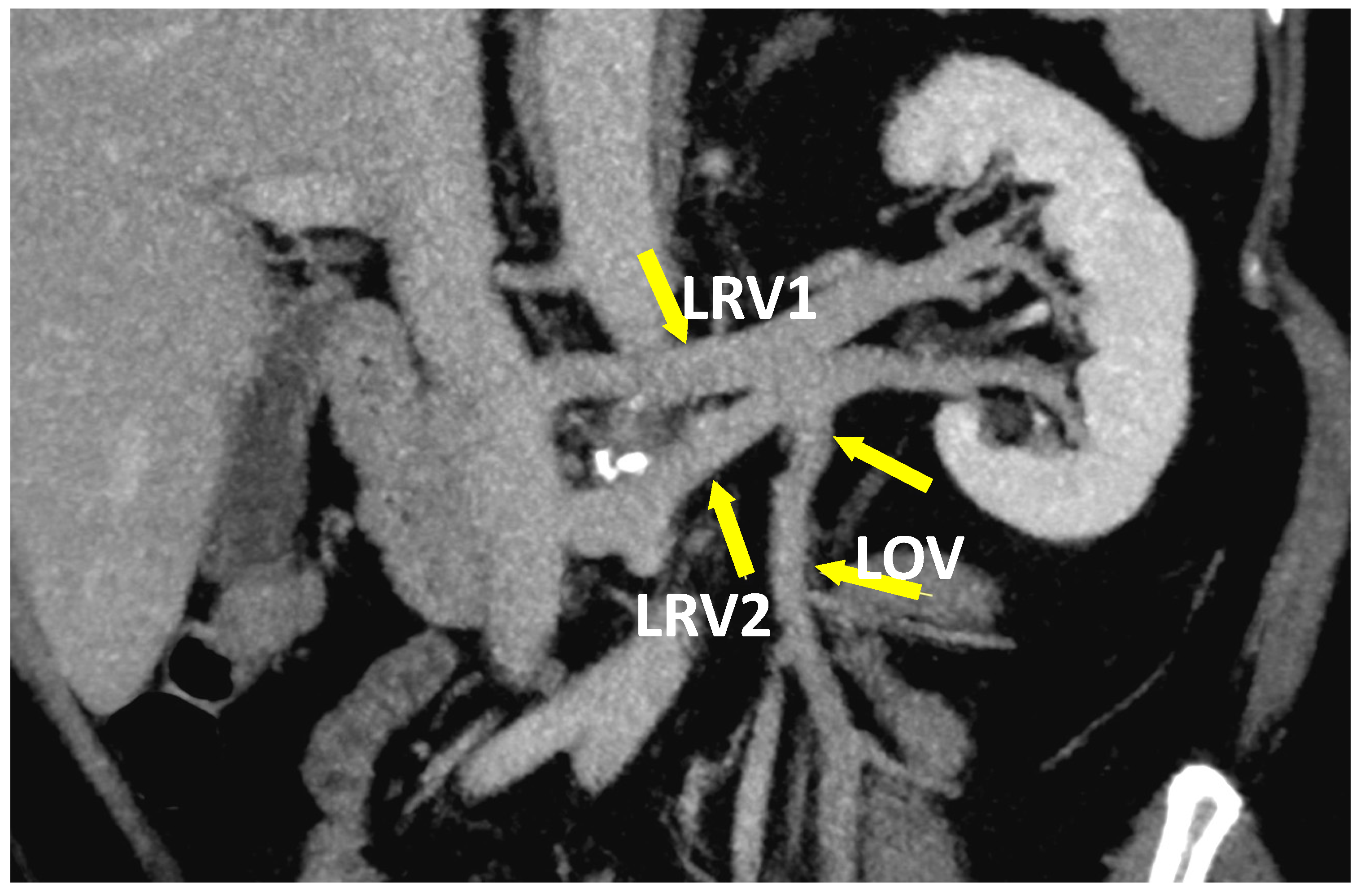 Jcm 10 00455 g006 Jcm 10 00455 g006