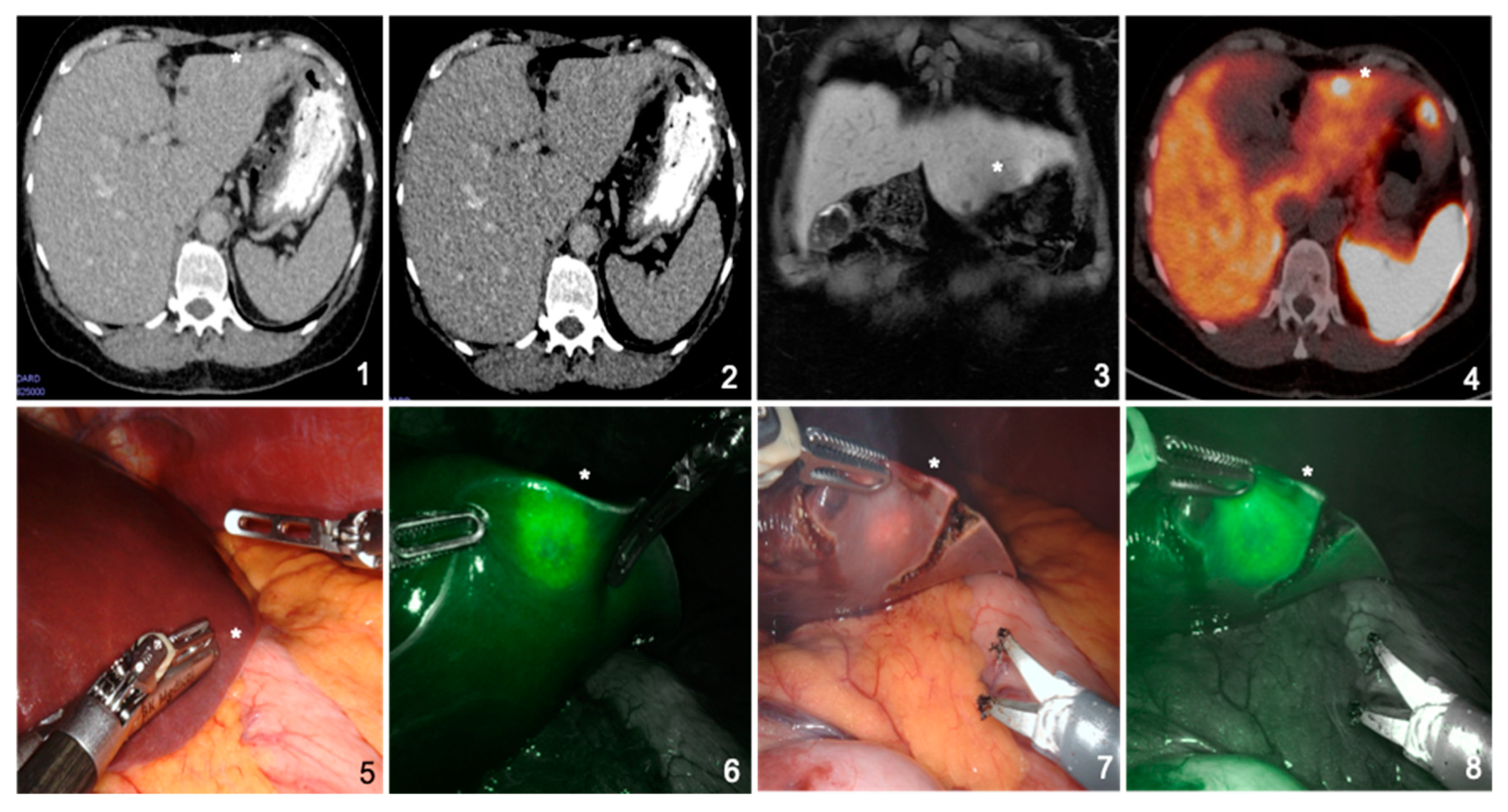 Jcm 10 00456 g003 Jcm 10 00456 g003