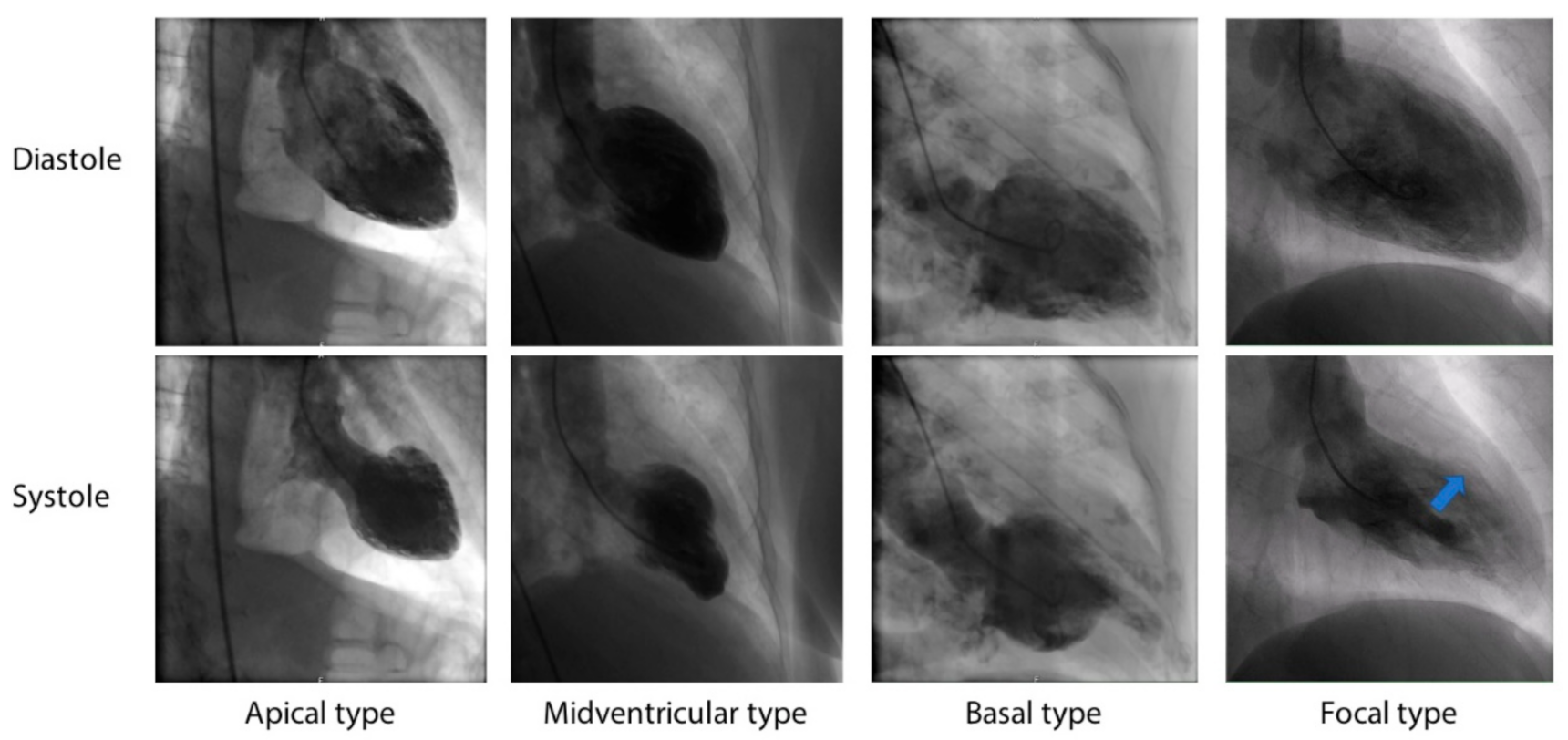 Jcm 10 00479 g001 Jcm 10 00479 g001