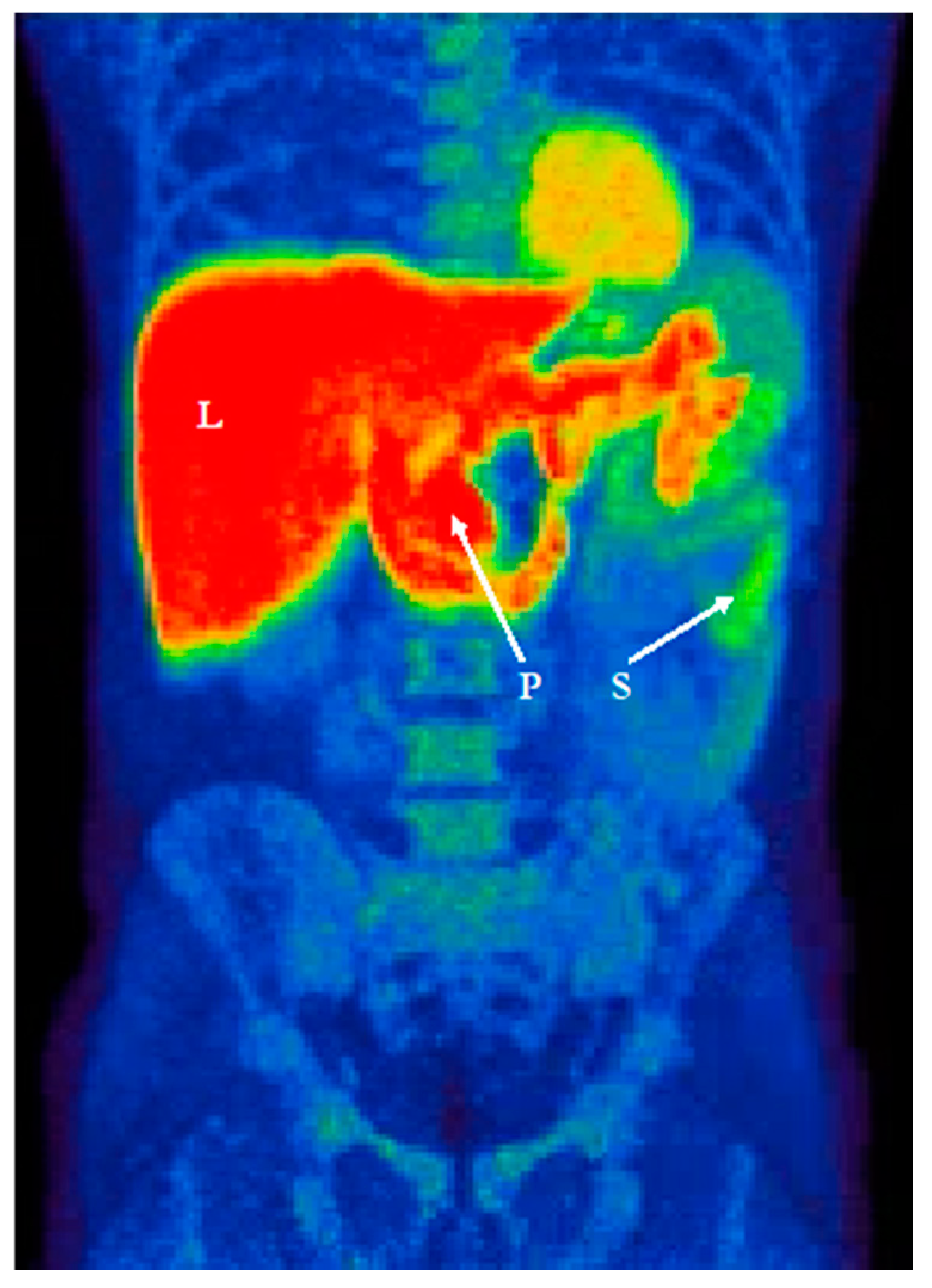 Jcm 10 00493 g003 Jcm 10 00493 g003
