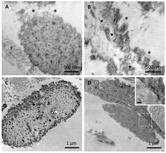 Dermal Alterations in Clinically Unaffected Skin of Pseudoxanthoma ...