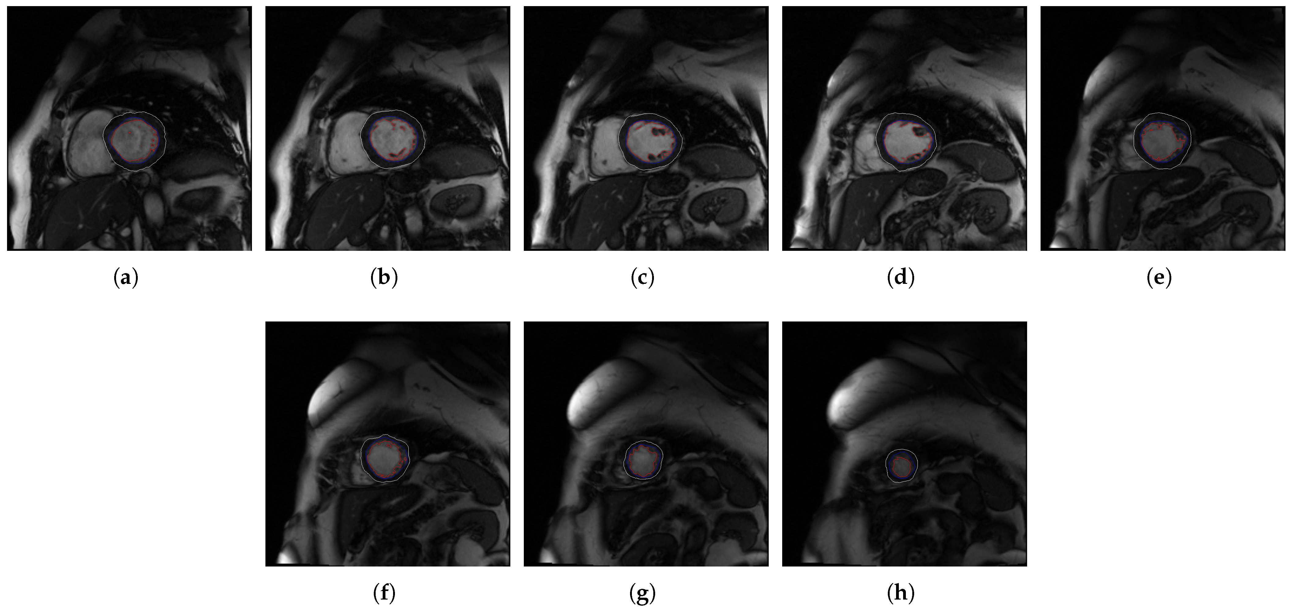 Jcm 10 00503 g004 Jcm 10 00503 g004
