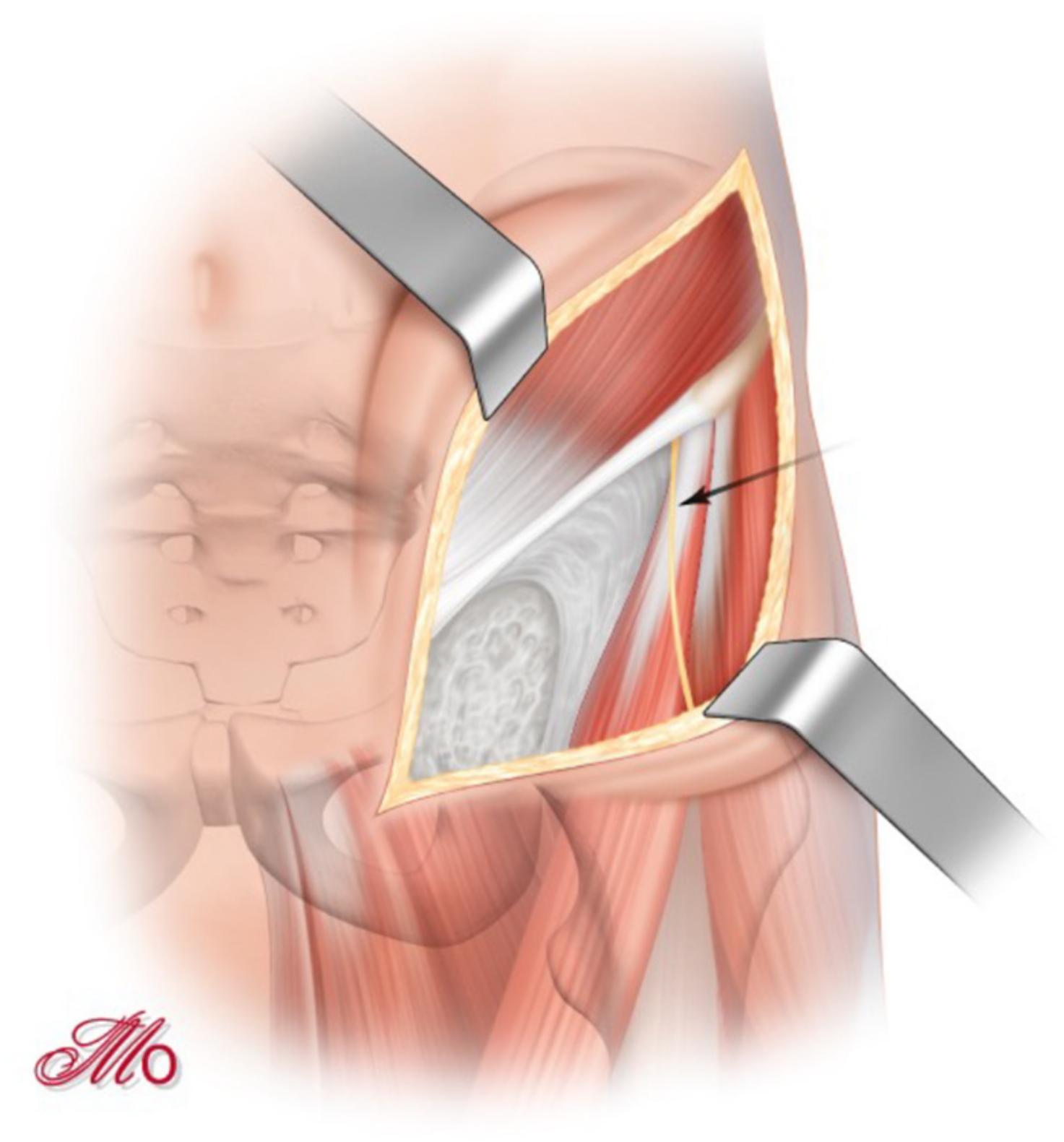 Jcm 10 00601 g001 Jcm 10 00601 g001
