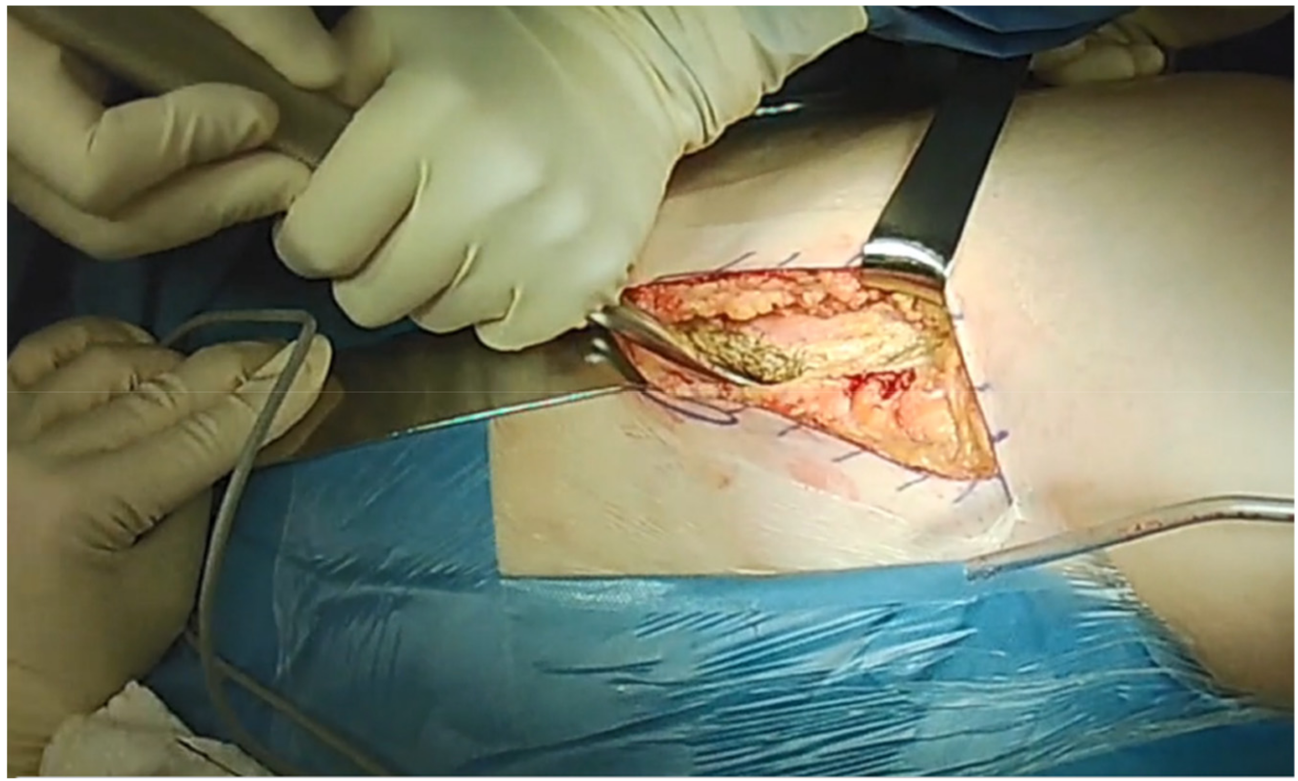 Jcm 10 00601 g002 Jcm 10 00601 g002